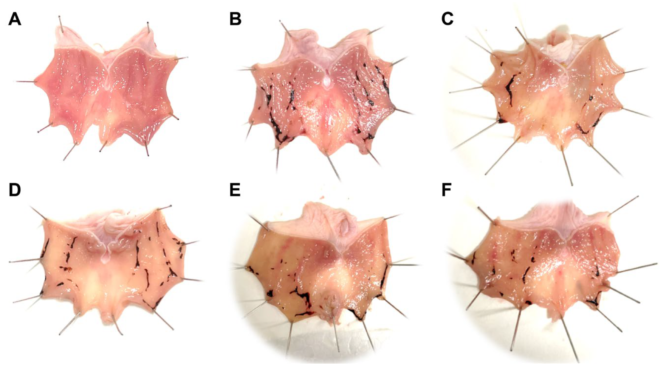 Medicina 59 00666 g008