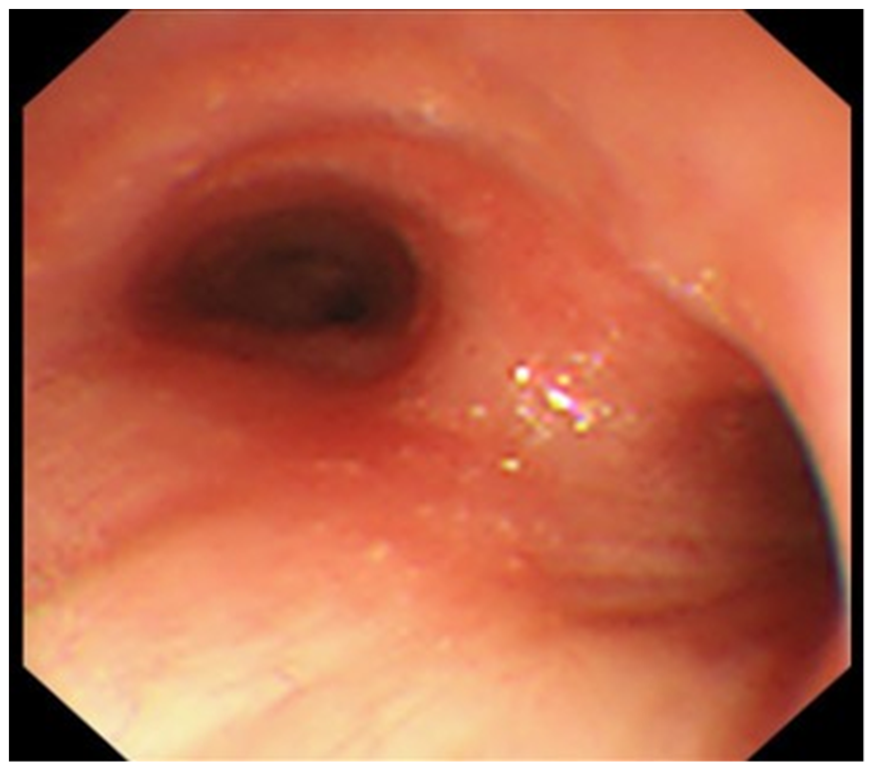 Medicina 59 00677 g003 Medicina 59 00677 g003