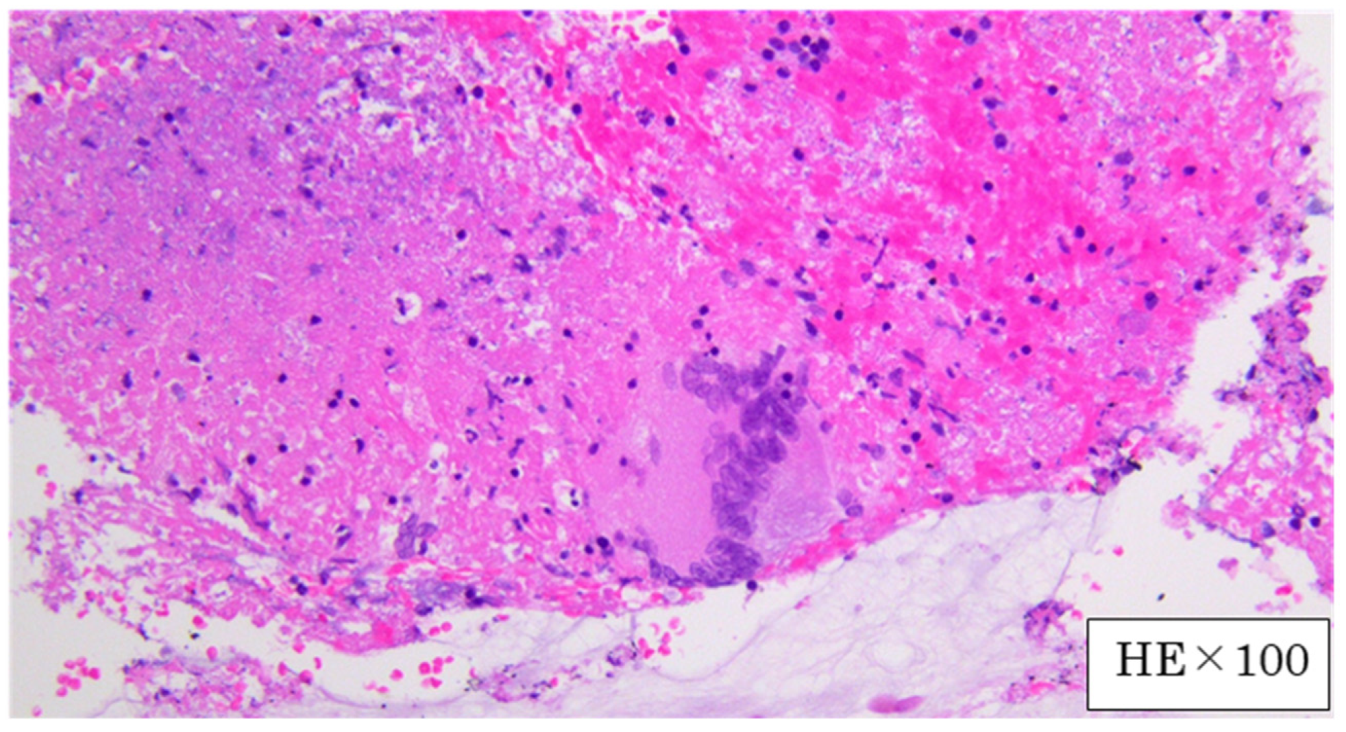 Medicina 59 00677 g004 Medicina 59 00677 g004