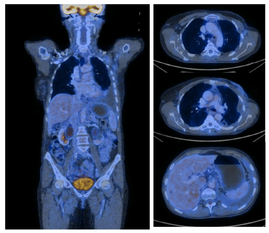 Medicina 59 00696 g003 Medicina 59 00696 g003