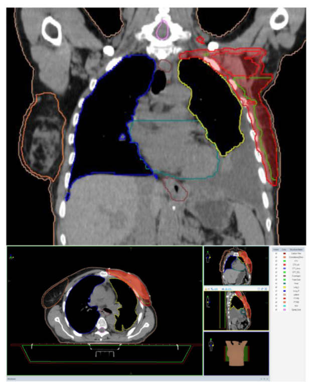 Medicina 59 00696 g004 Medicina 59 00696 g004