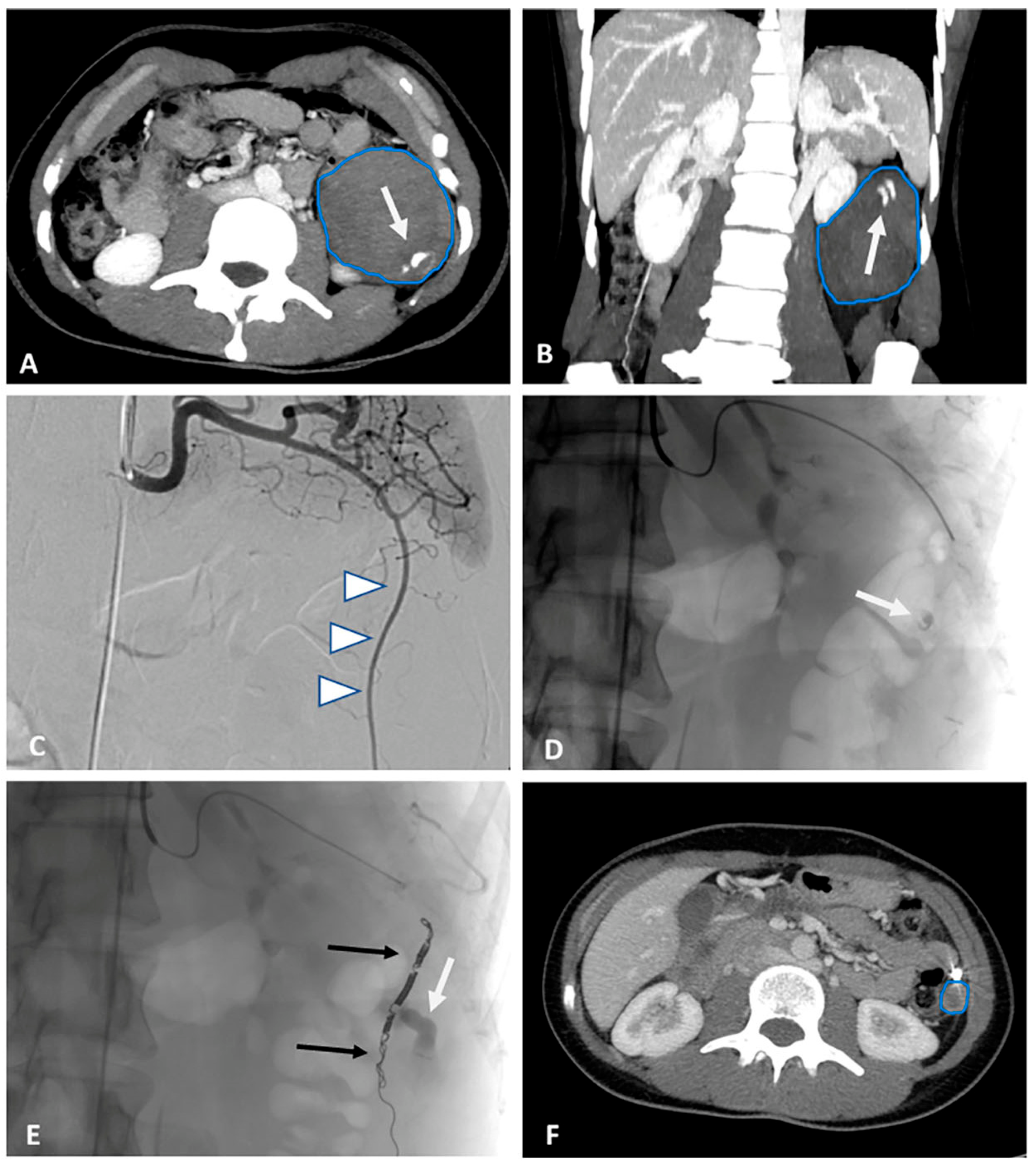 Medicina 59 00701 g001