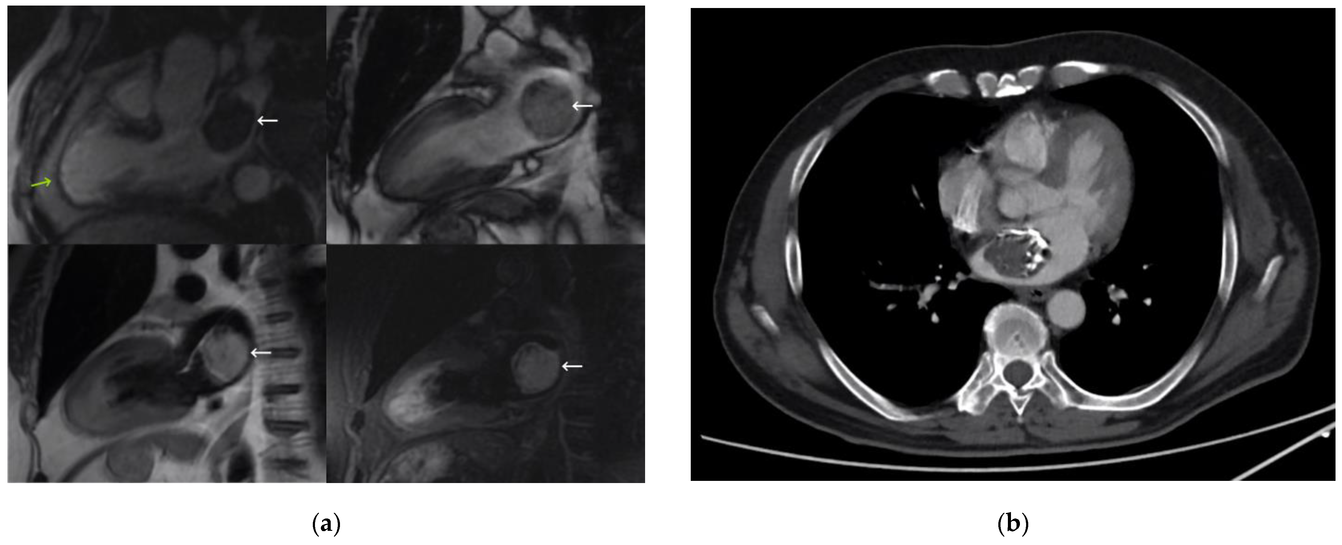 Medicina 59 00705 g003