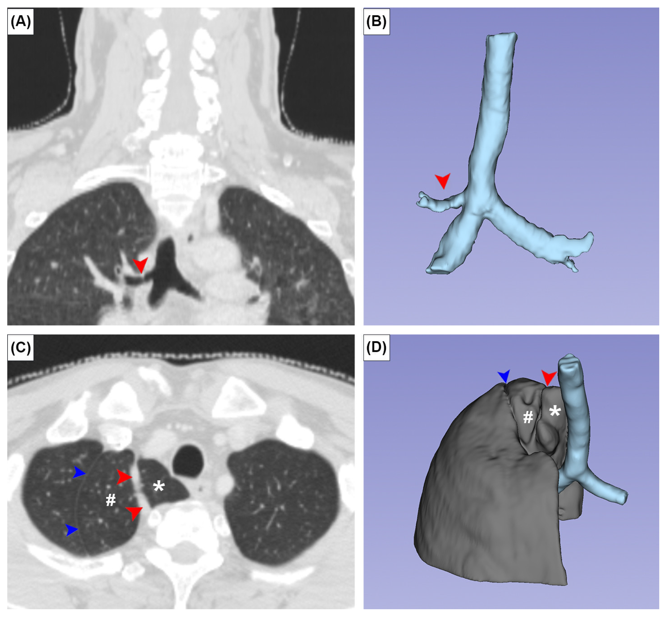 Medicina 59 00707 g004