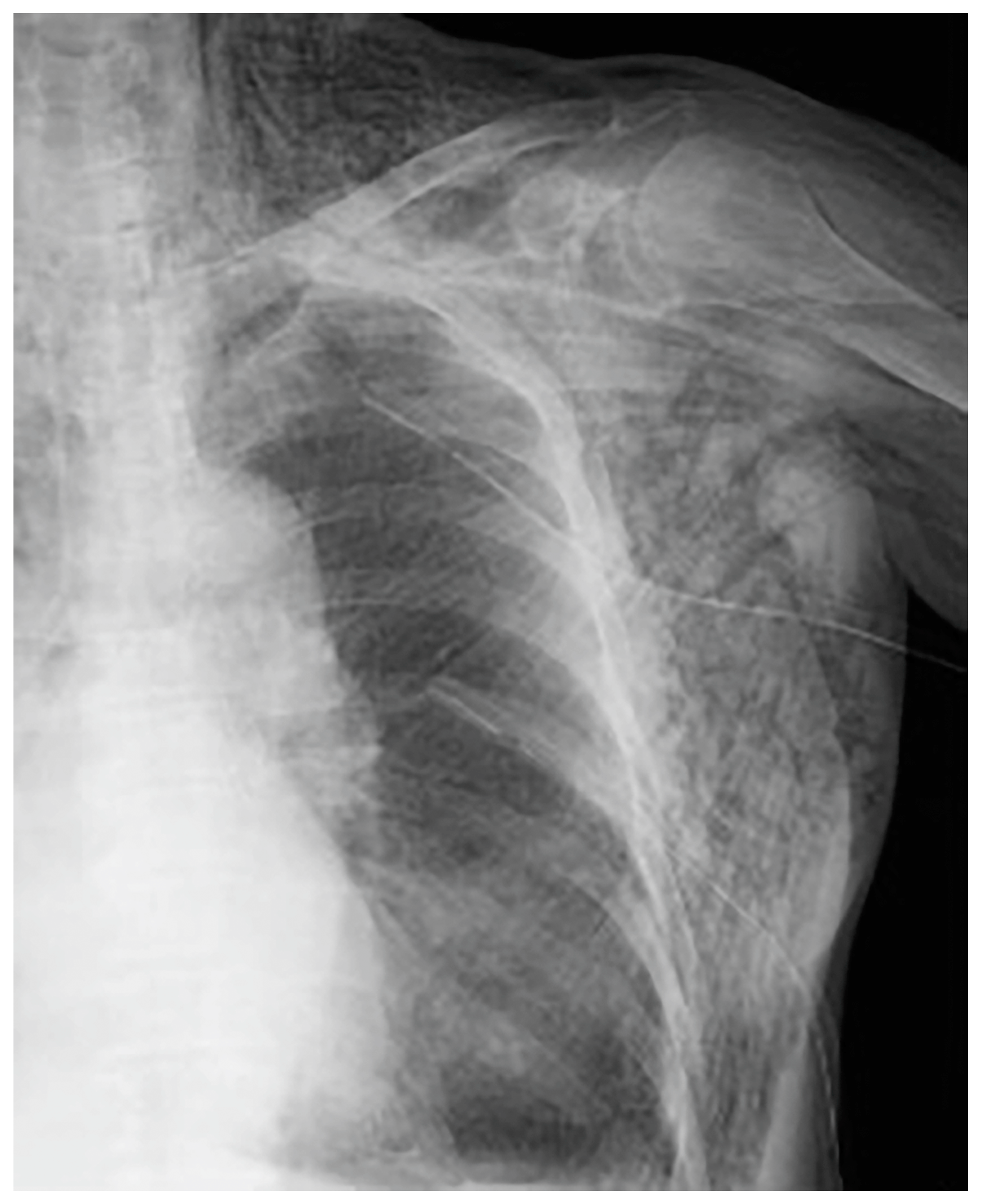 Medicina 59 00709 g004