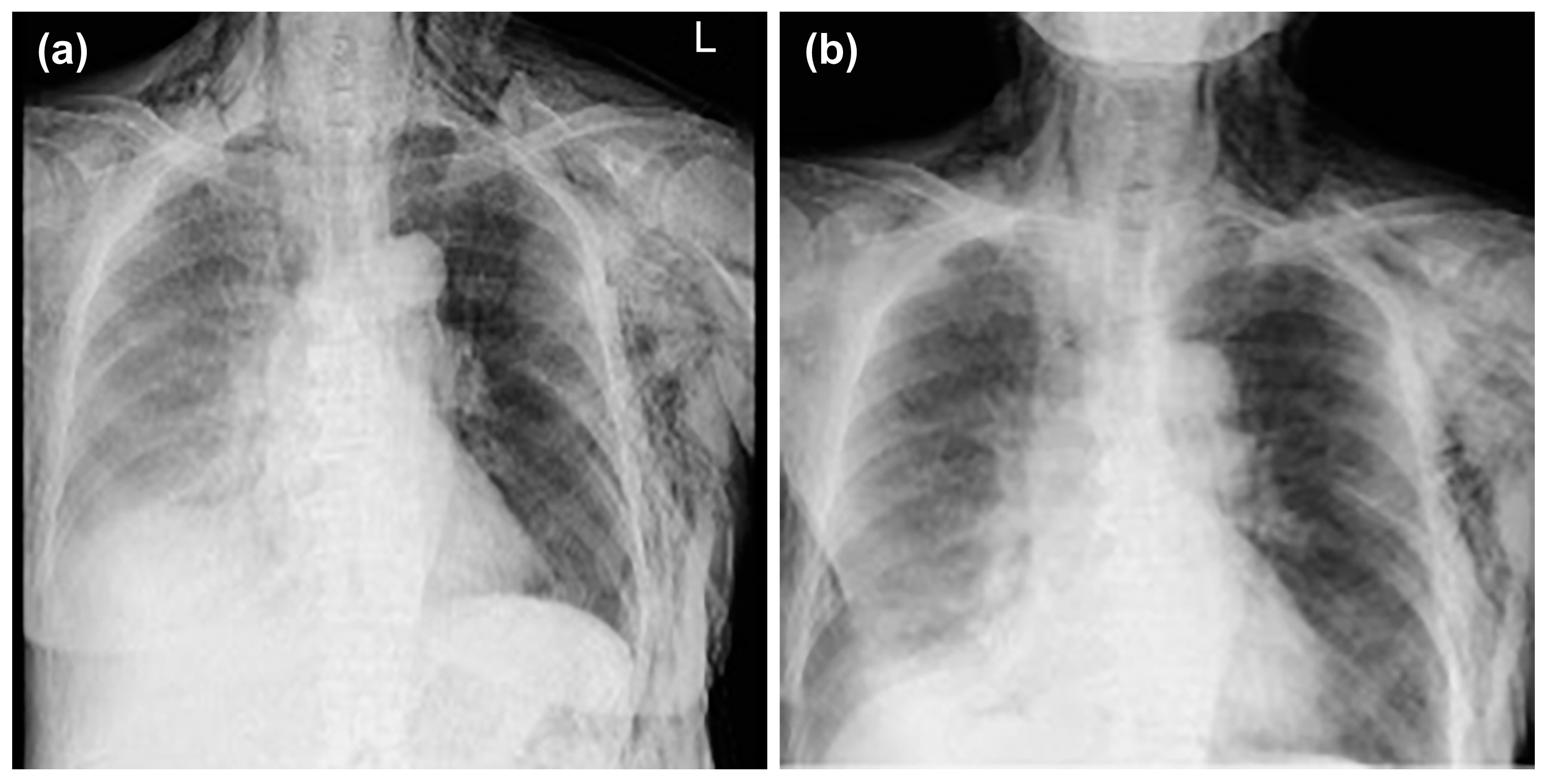 Medicina 59 00709 g005