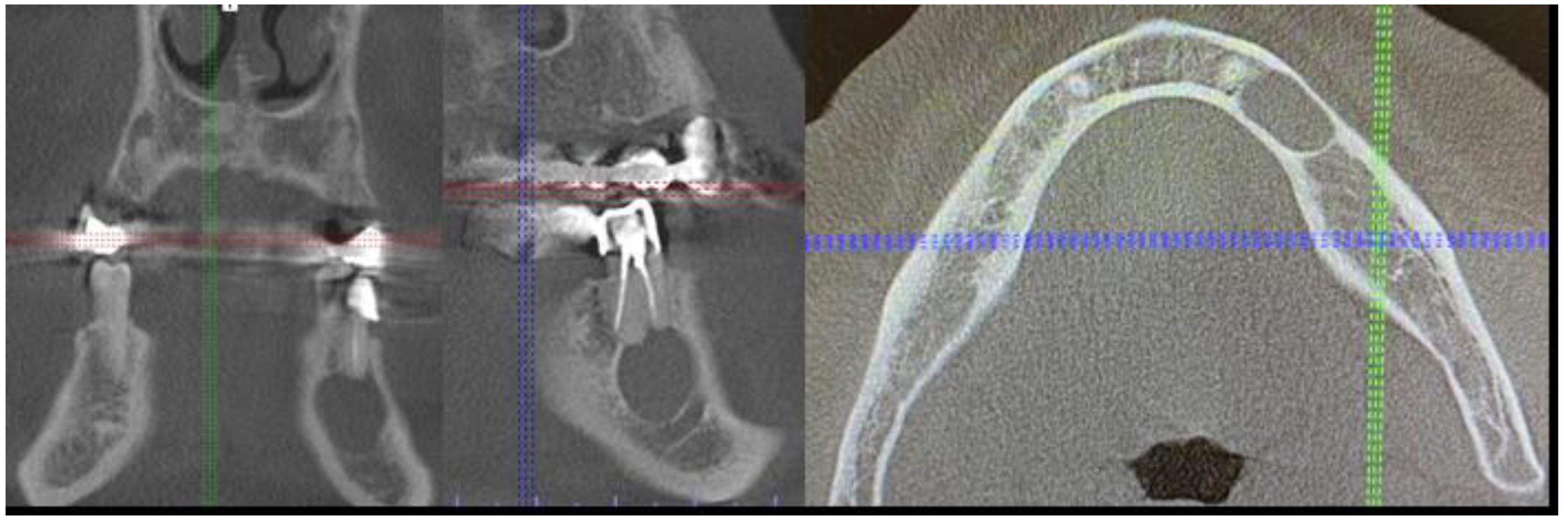 Medicina 59 00711 g004 Medicina 59 00711 g004