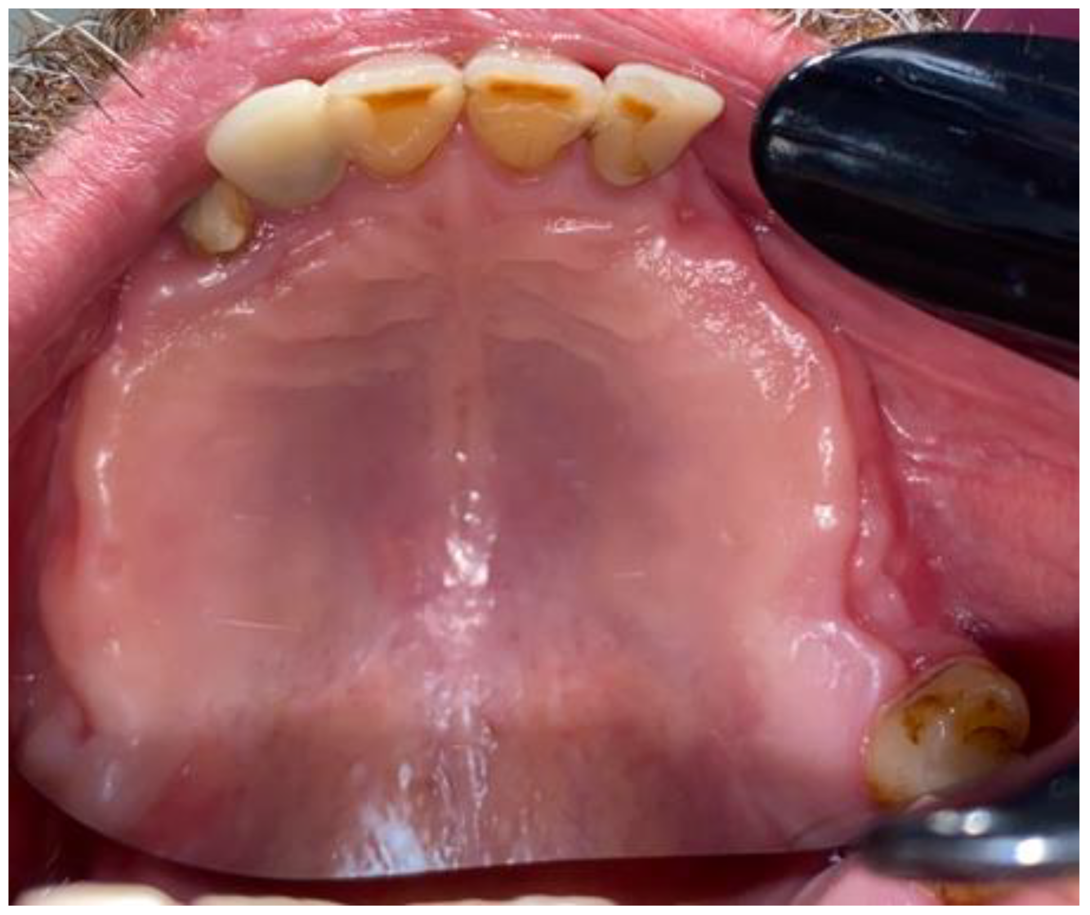 Medicina 59 00711 g006 Medicina 59 00711 g006