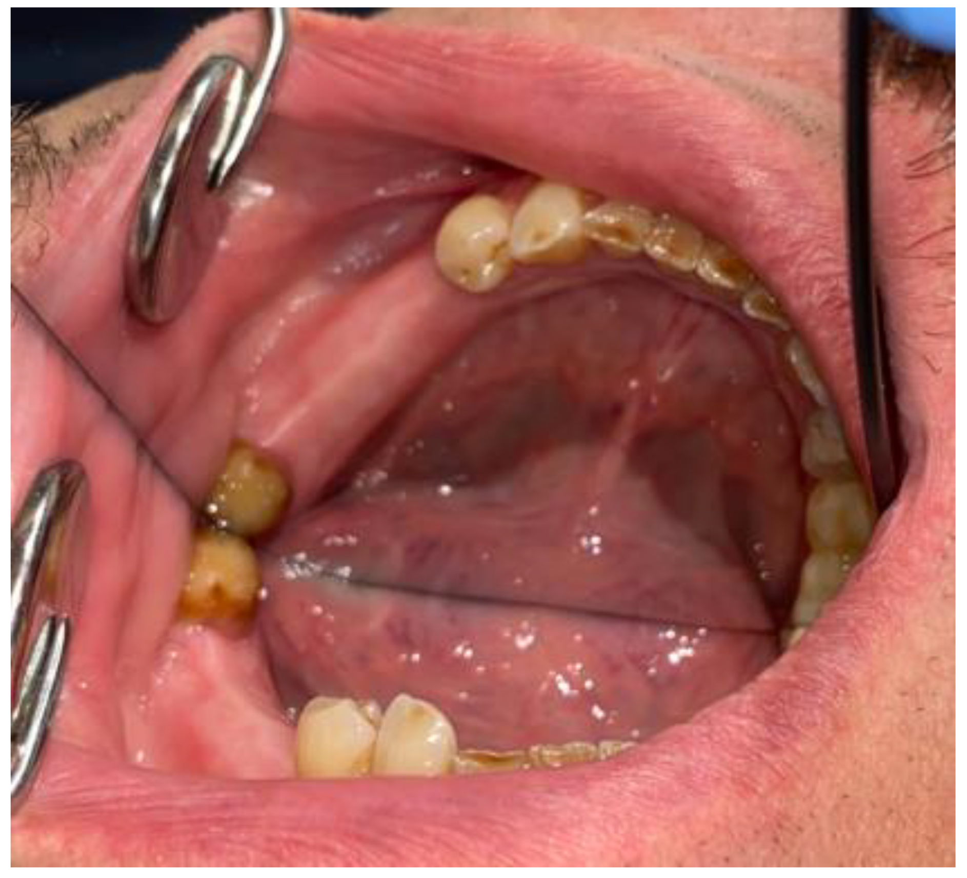 Medicina 59 00711 g007 Medicina 59 00711 g007