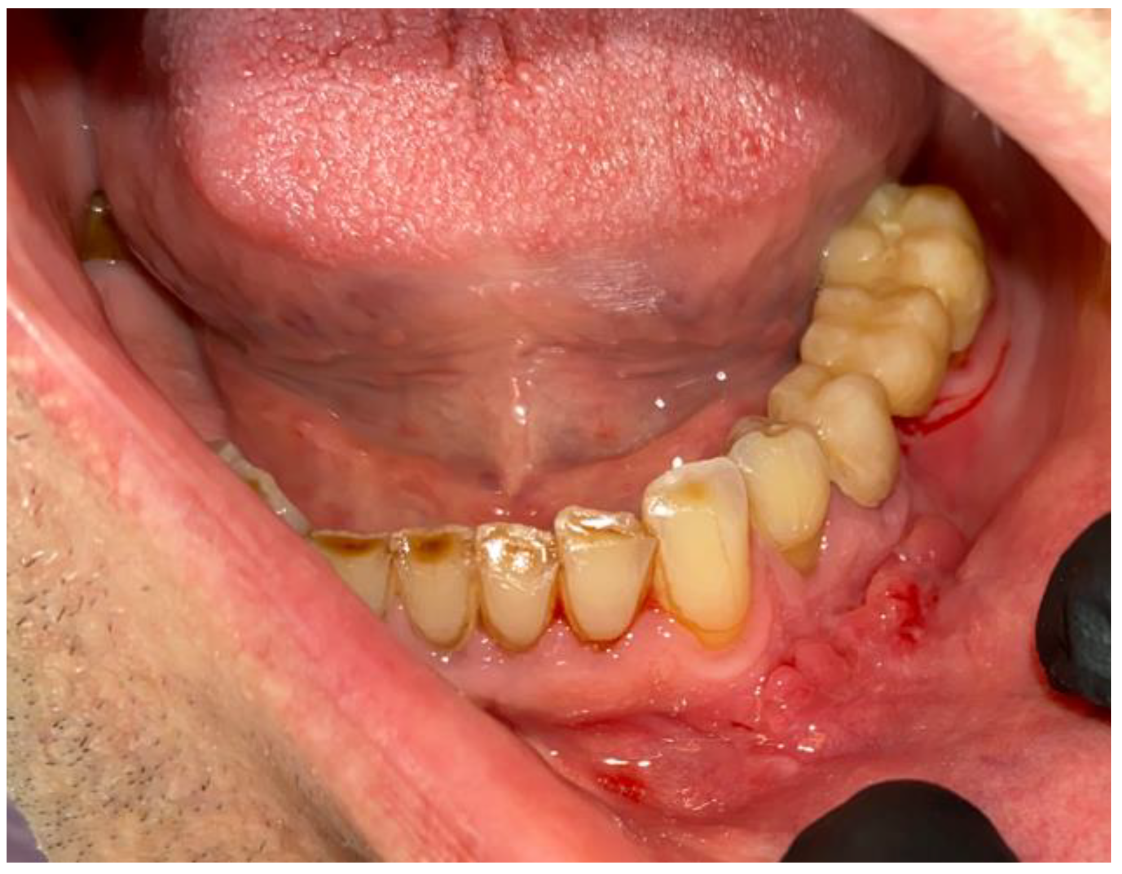 Medicina 59 00711 g009 Medicina 59 00711 g009