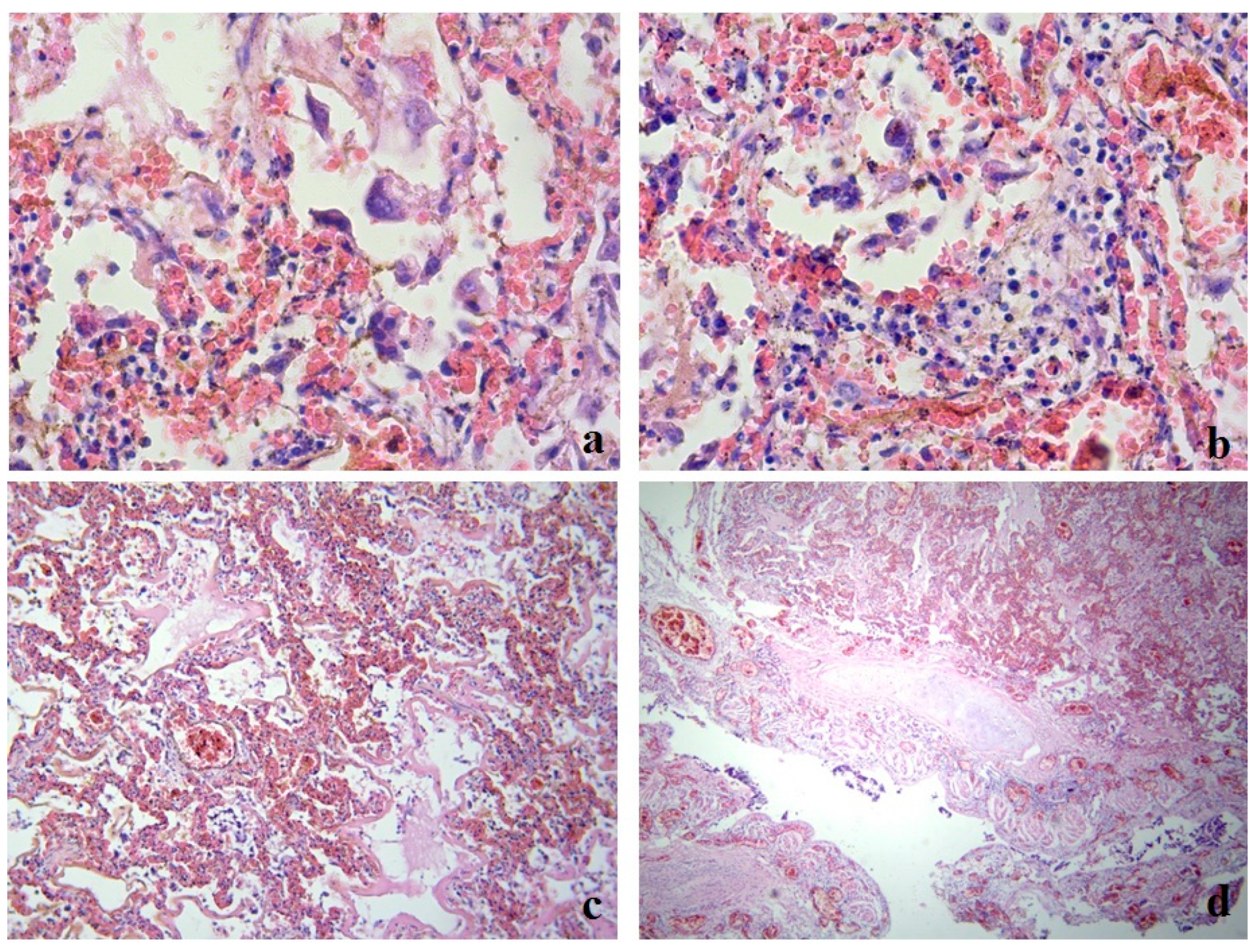 Medicina 59 00714 g001