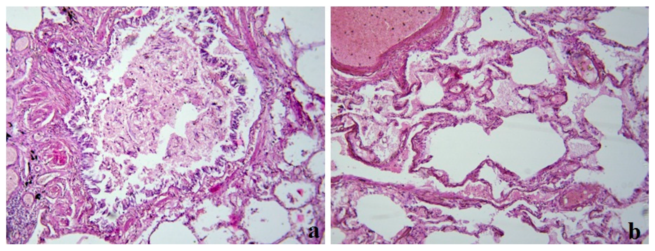 Medicina 59 00714 g003