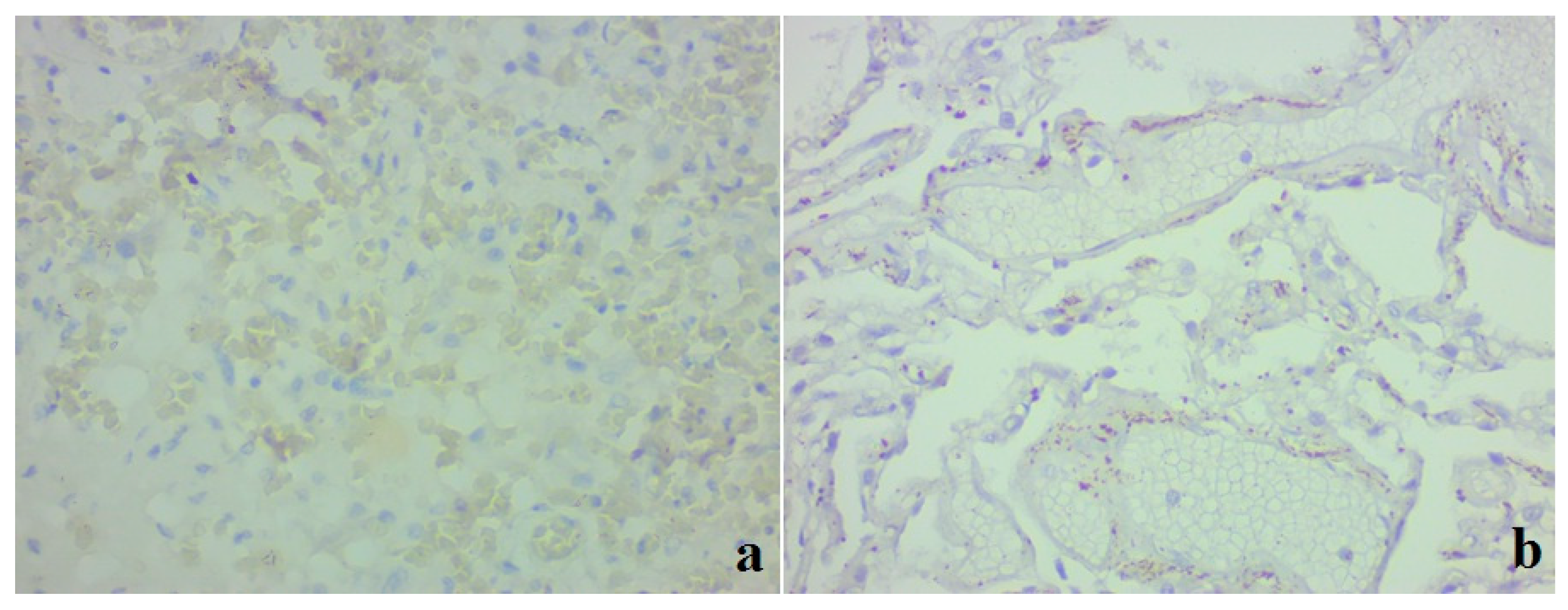 Medicina 59 00714 g005