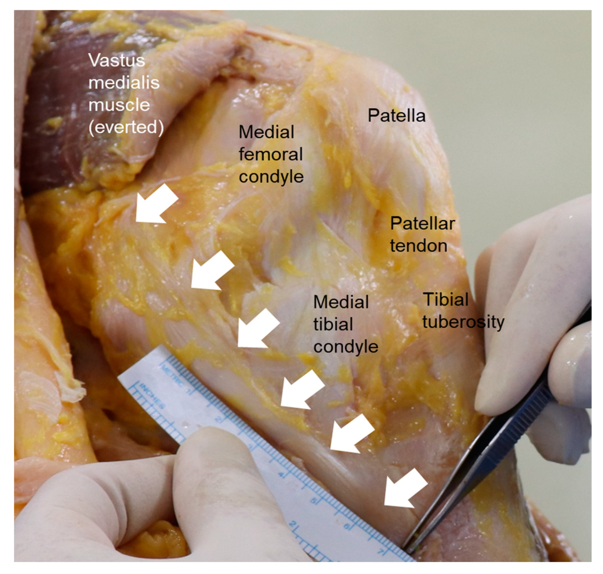 Medicina 59 00725 g001 Medicina 59 00725 g001