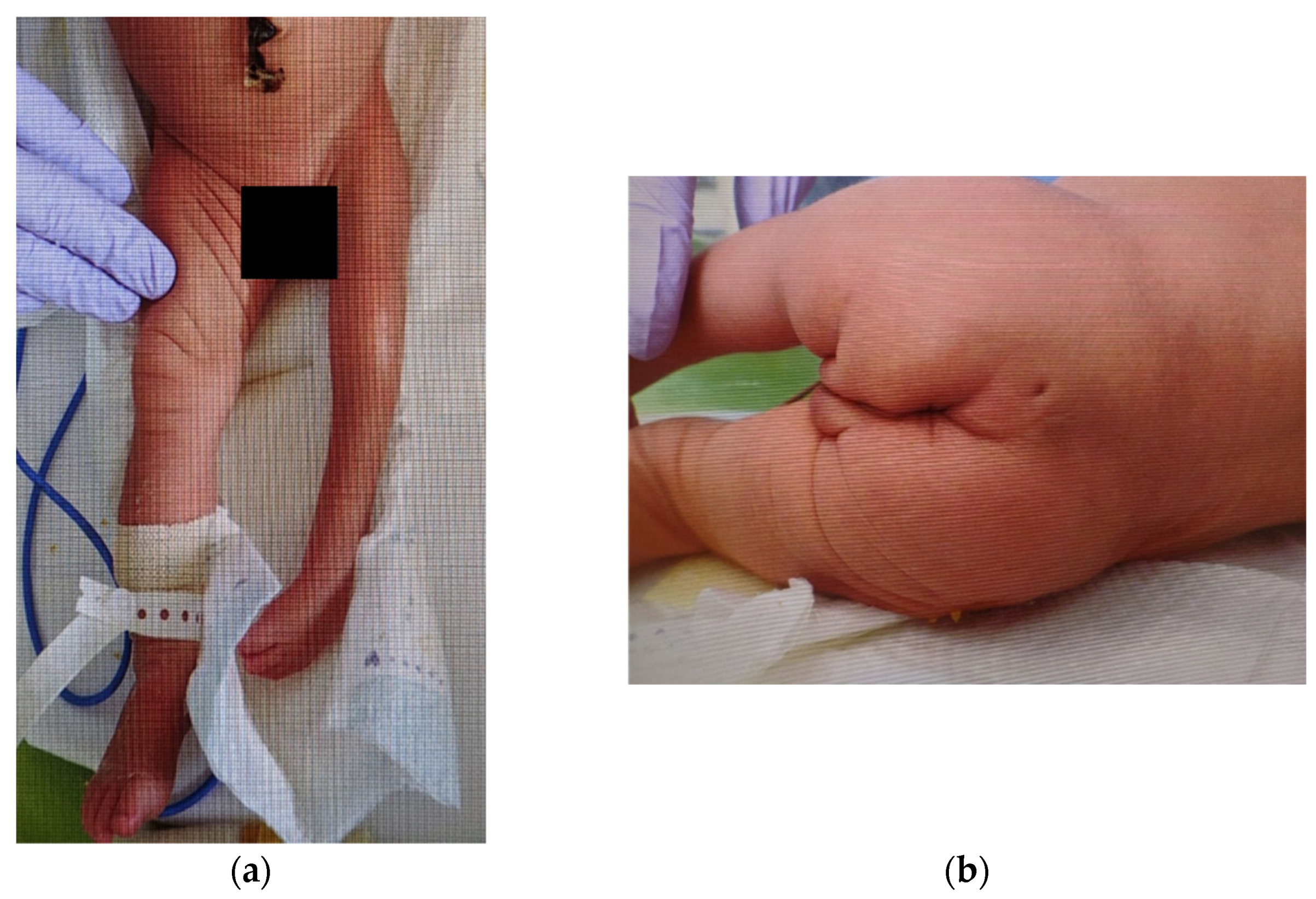 Medicina 59 00726 g001 550