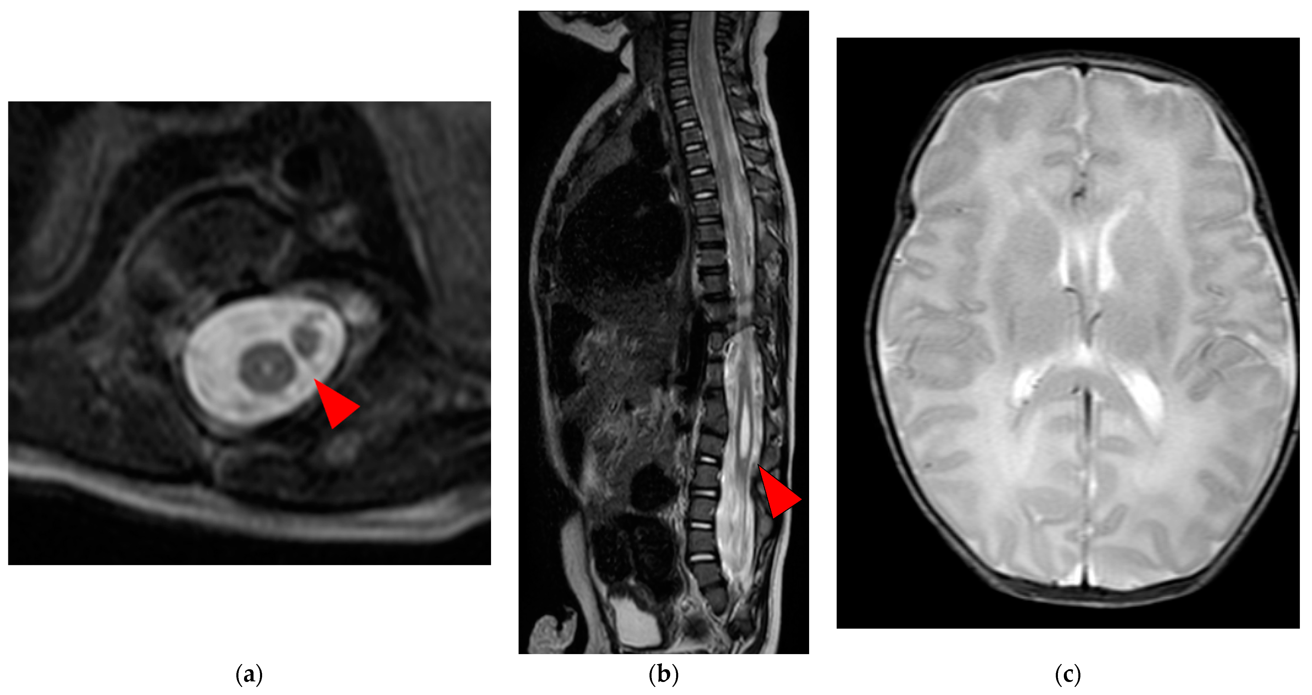 Medicina 59 00726 g002 550
