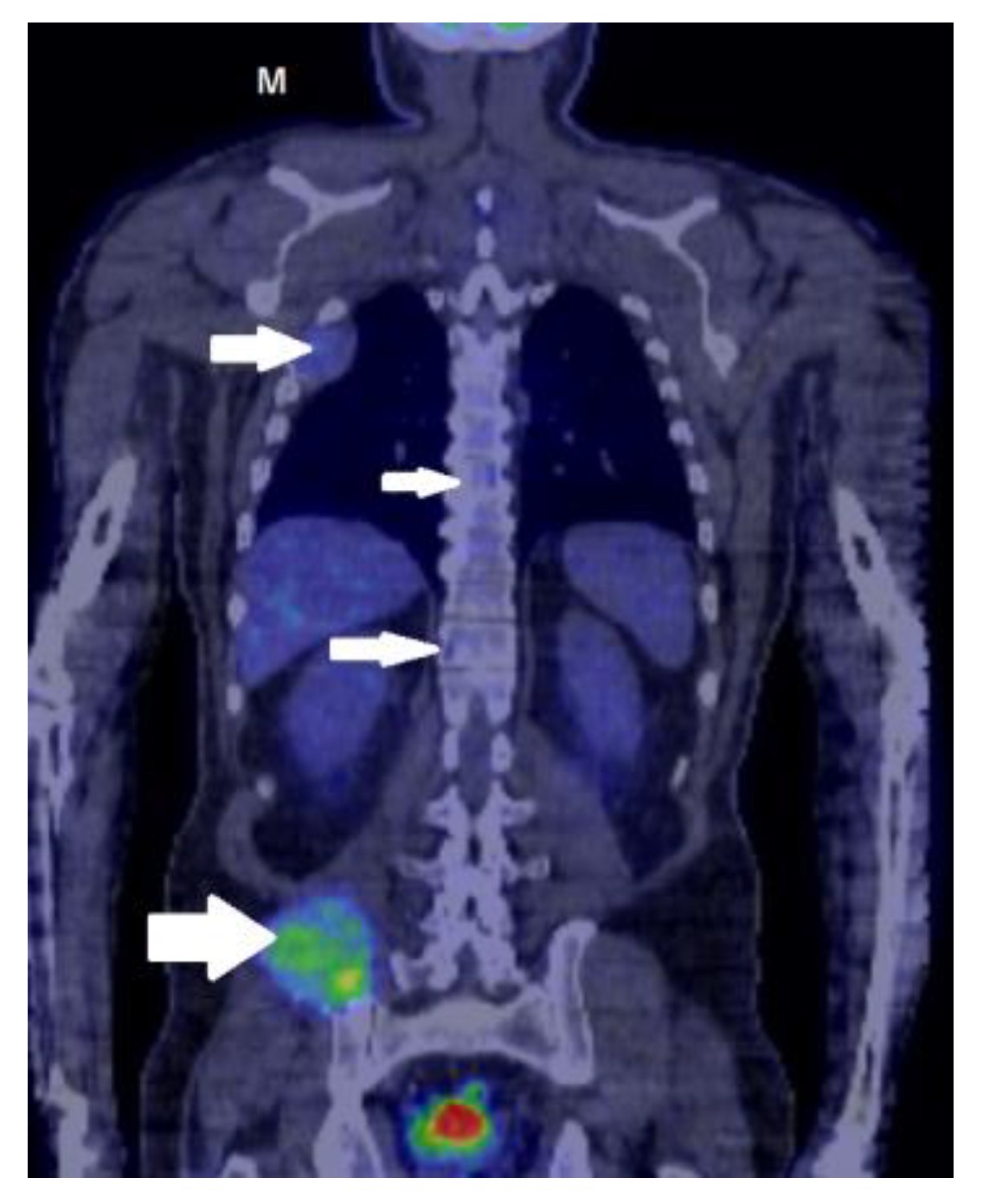 Medicina 59 00731 g005