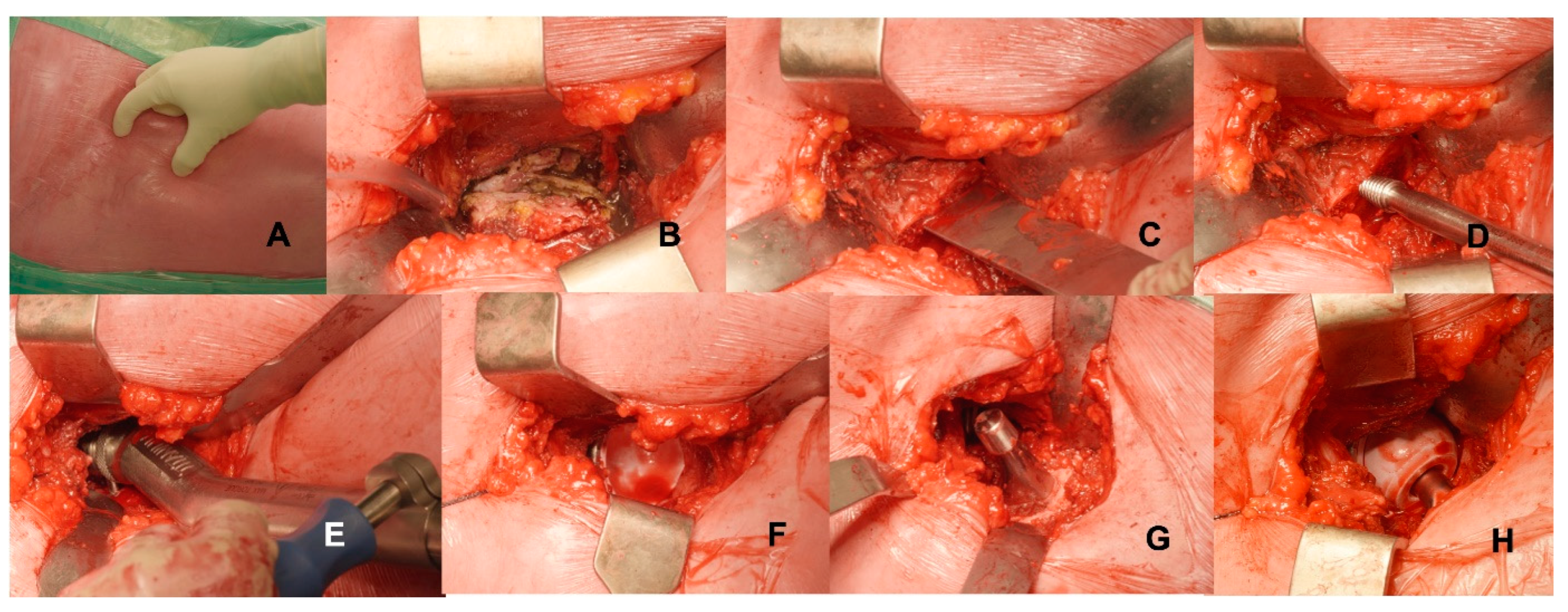 Medicina 59 00769 g003