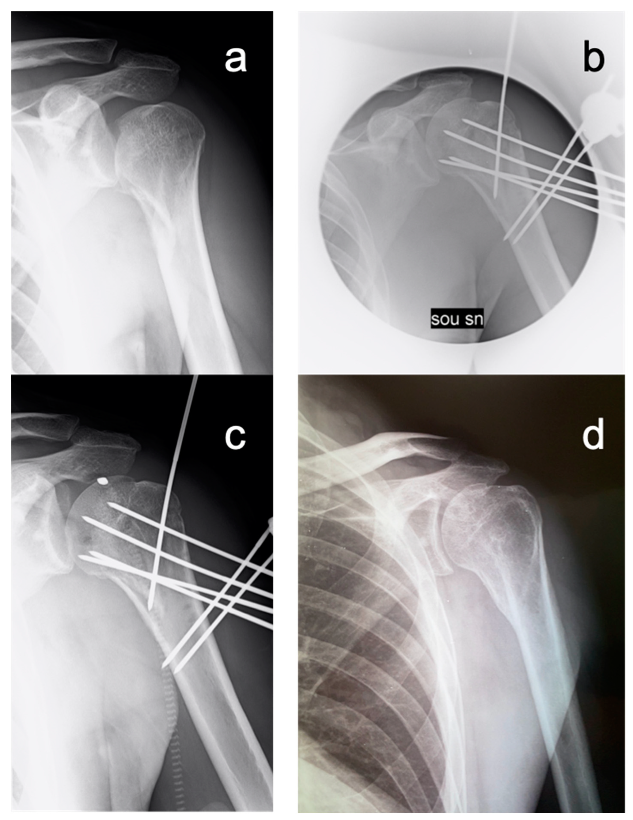 Medicina 59 00772 g004