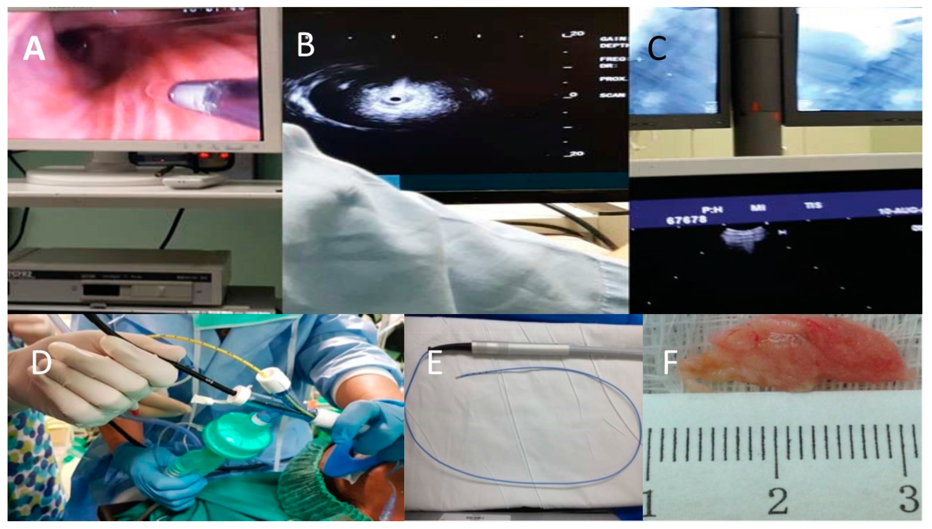 Medicina 59 00787 g001 Medicina 59 00787 g001