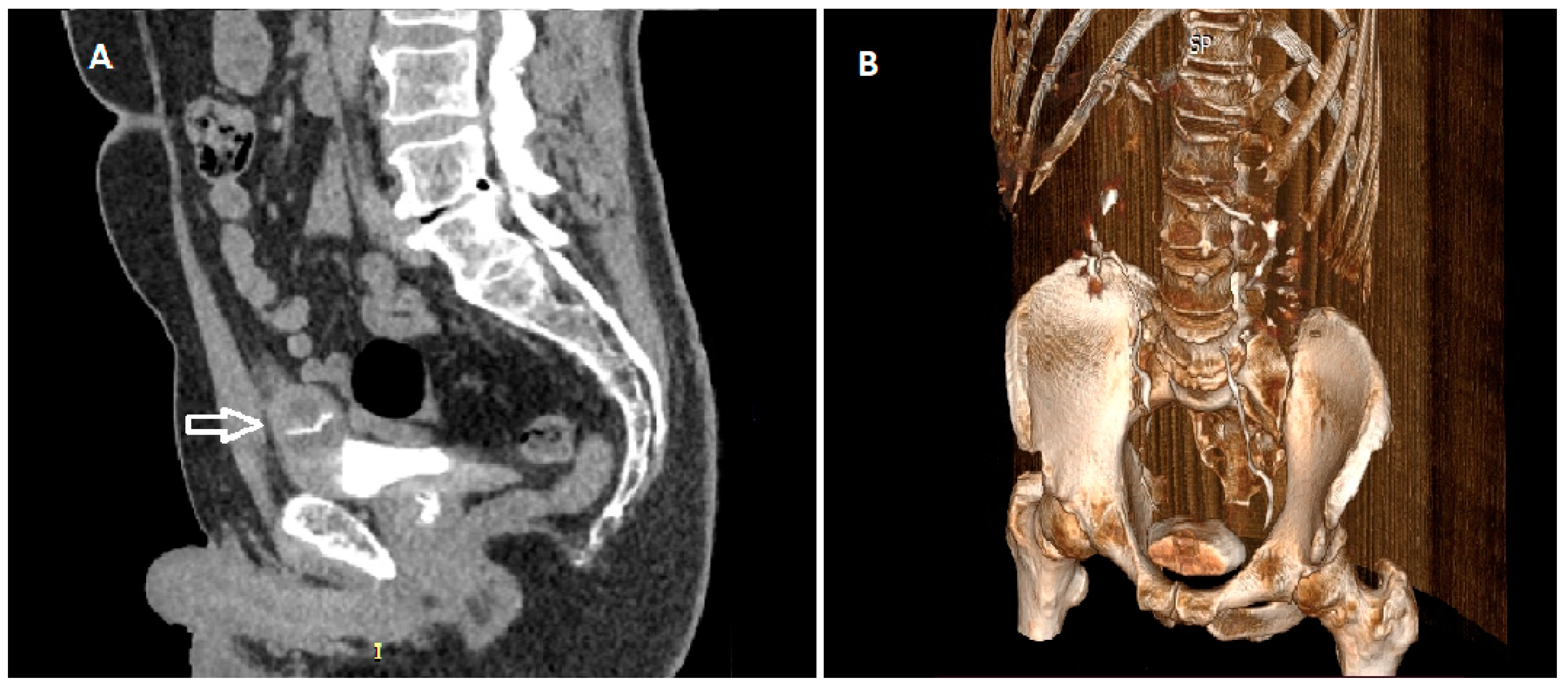 Medicina 59 00791 g002 Medicina 59 00791 g002