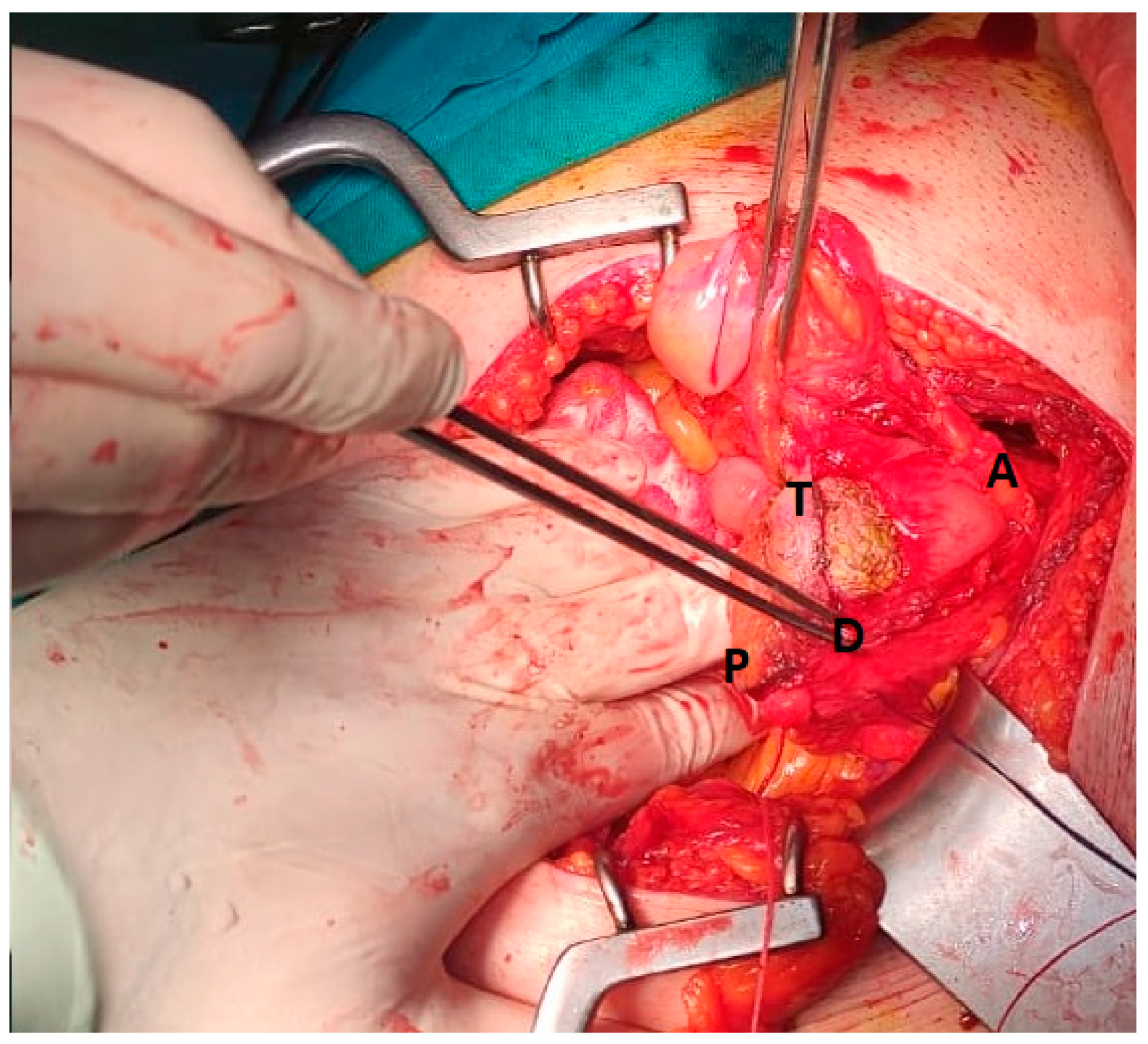 Medicina 59 00791 g003 Medicina 59 00791 g003