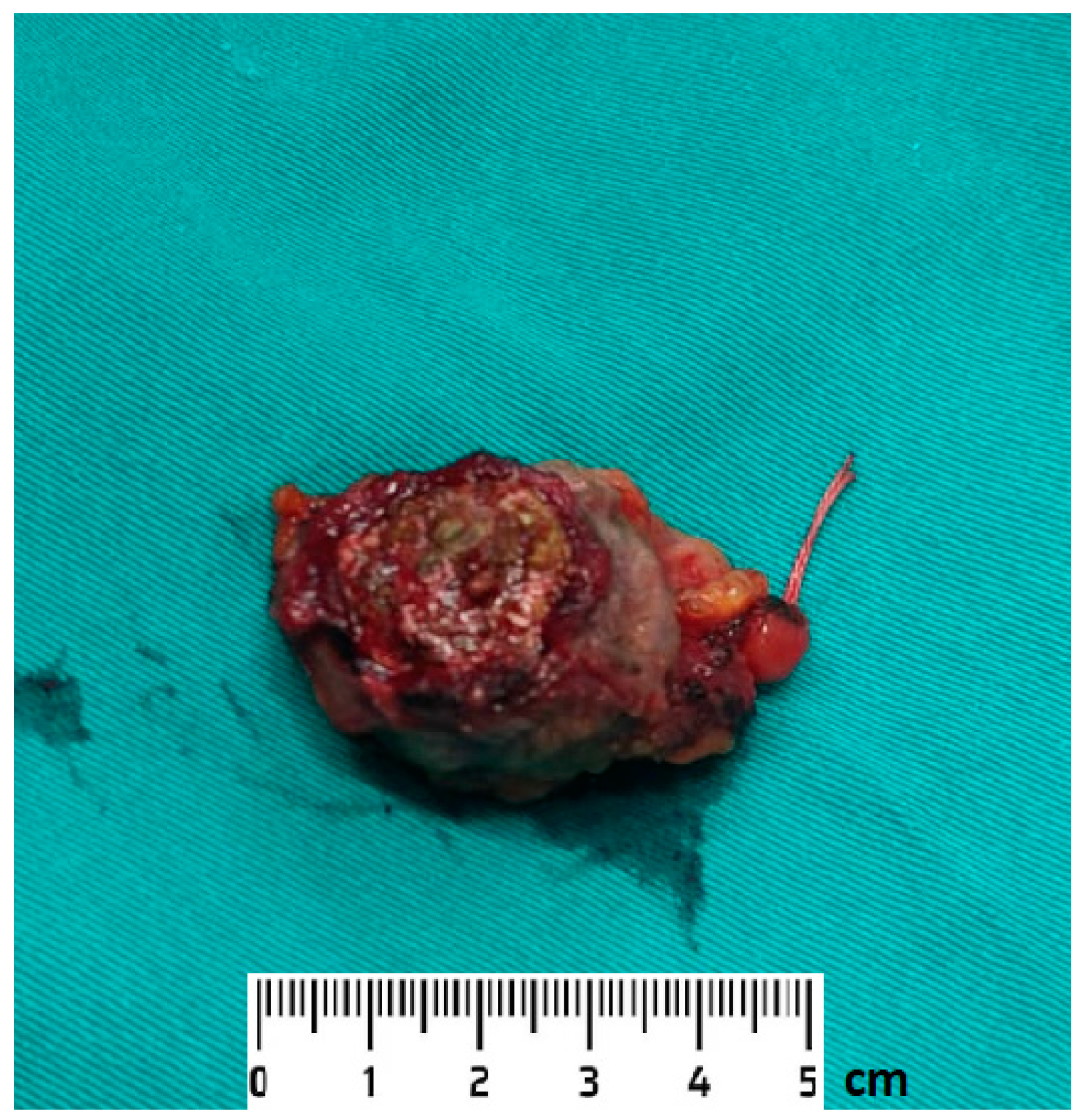 Medicina 59 00791 g004 Medicina 59 00791 g004