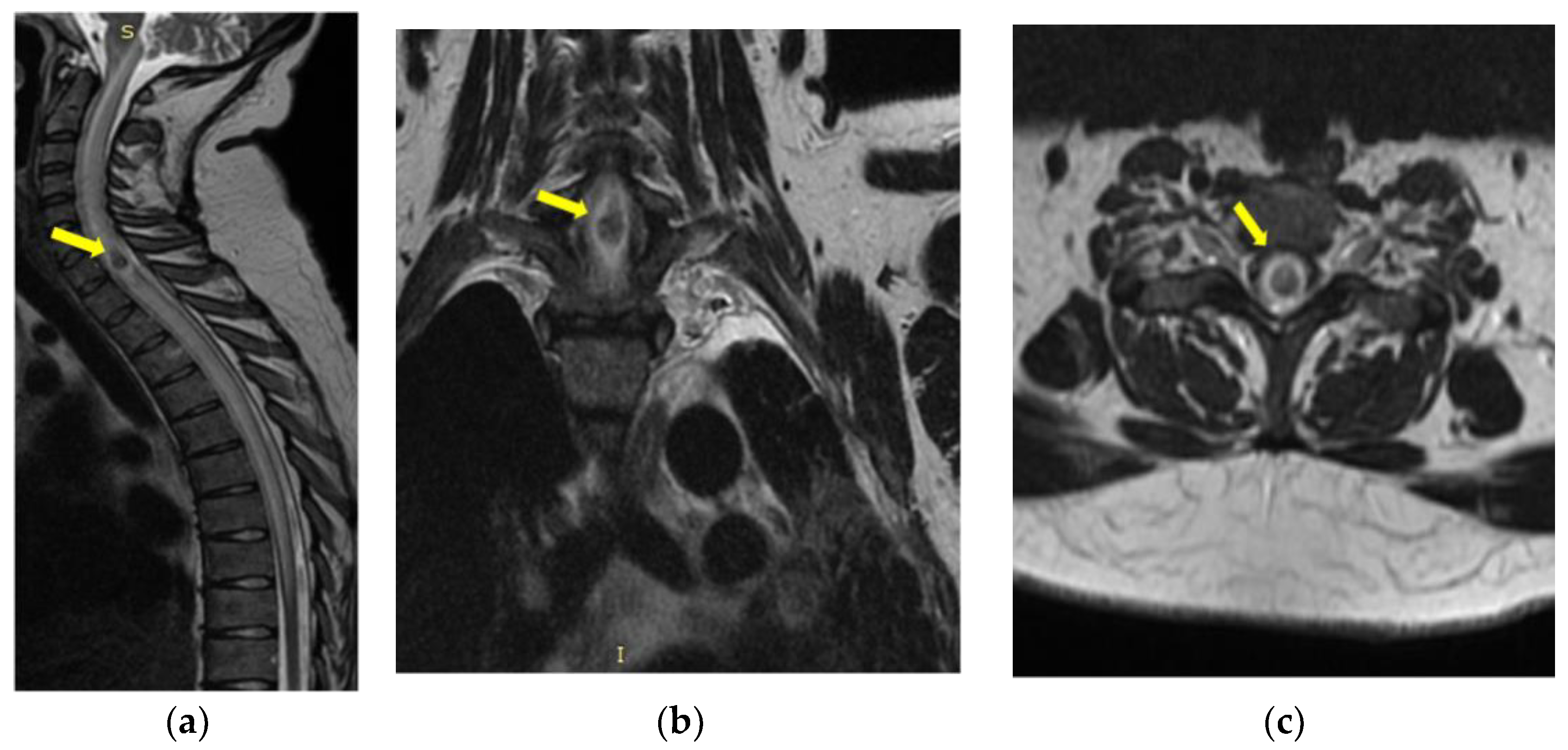 Medicina 59 00806 g004 Medicina 59 00806 g004