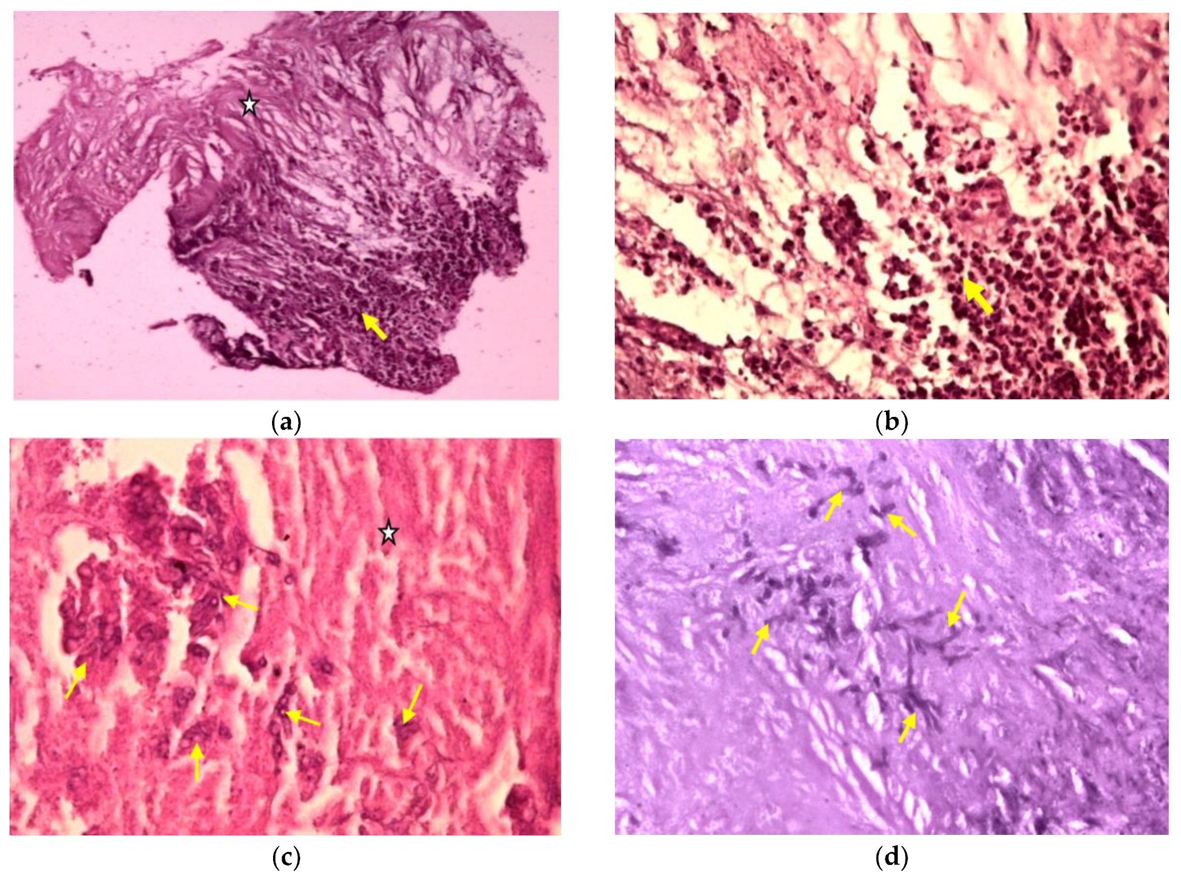 Medicina 59 00806 g007 Medicina 59 00806 g007