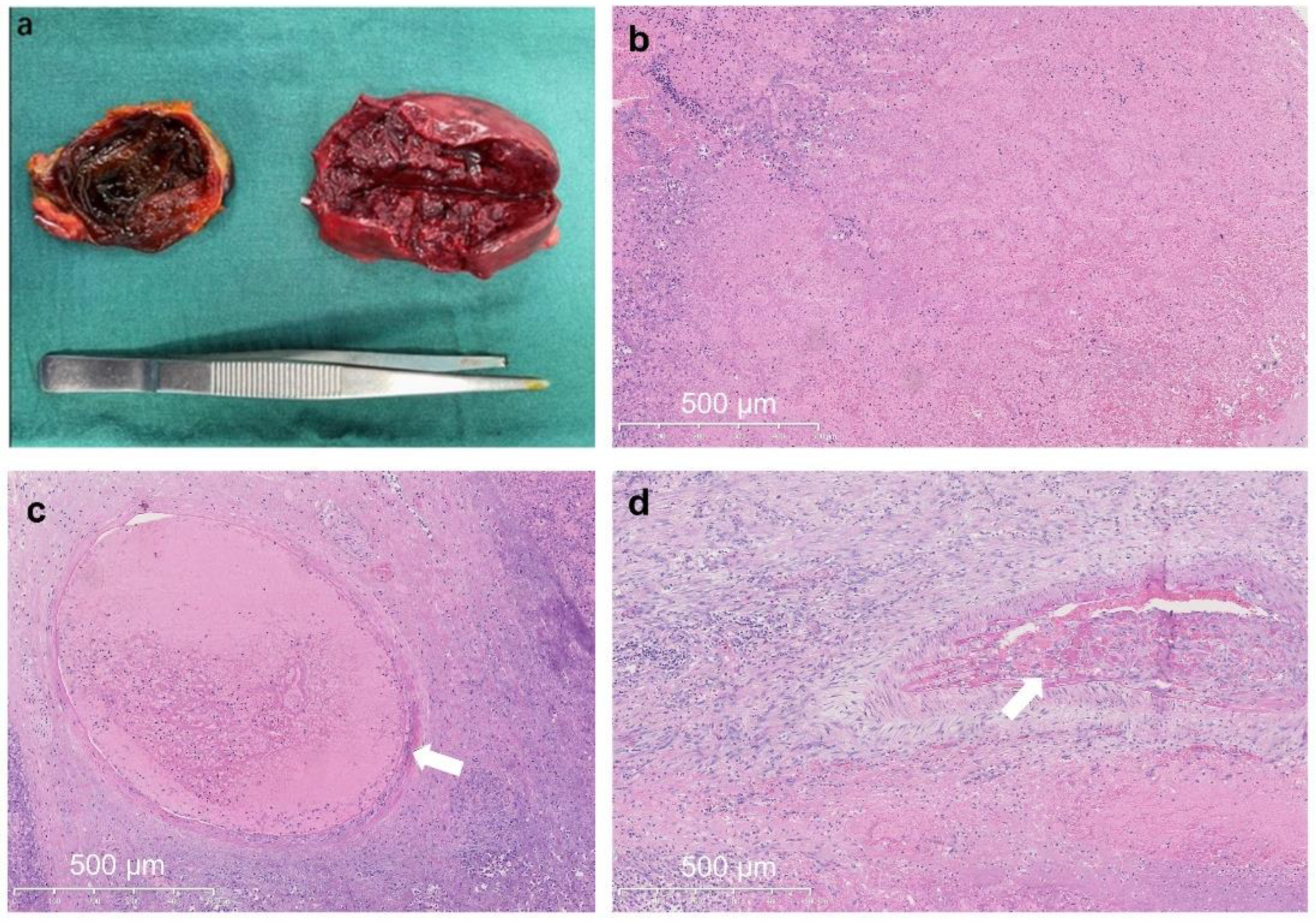 Medicina 59 00807 g004