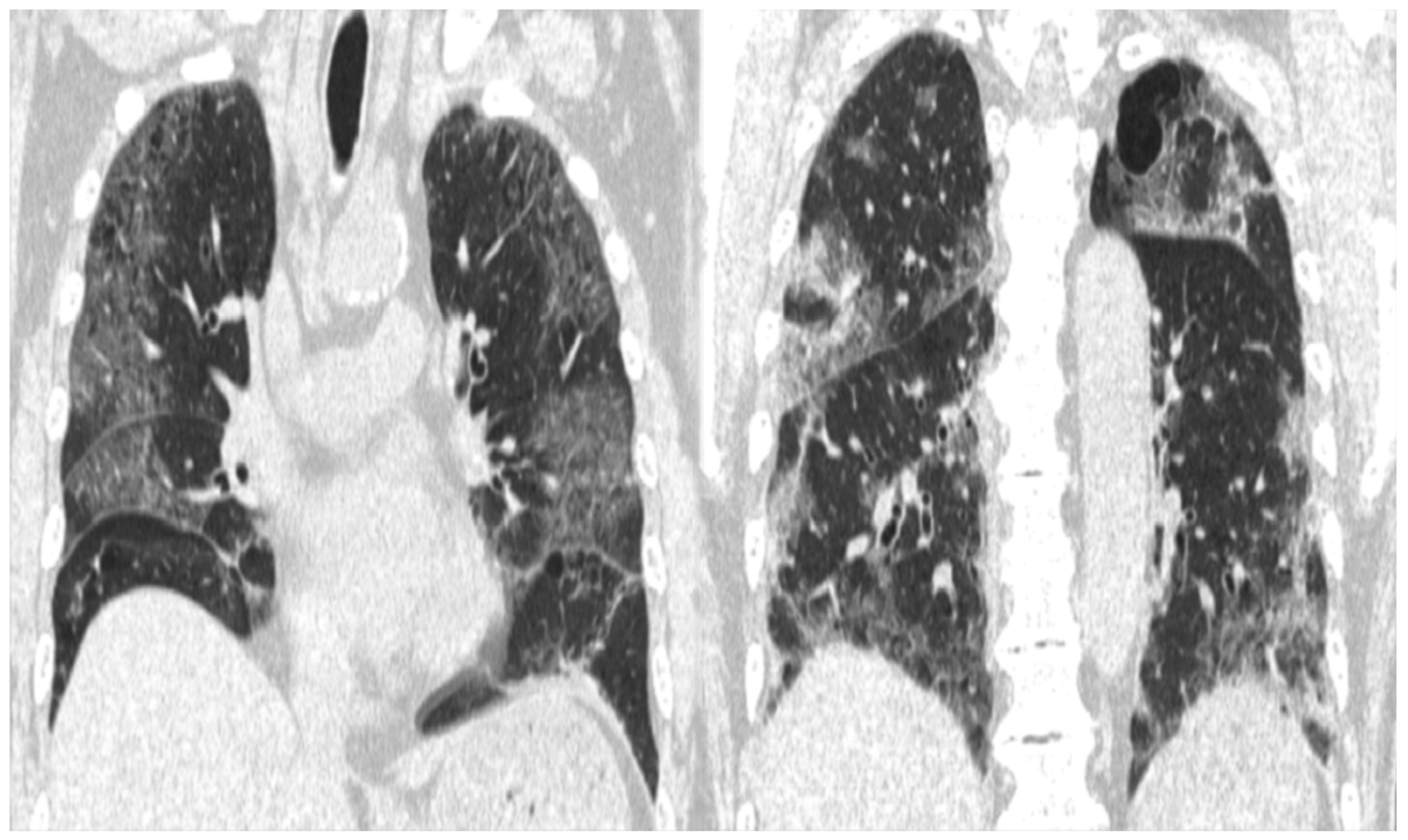 Medicina 59 00816 g001