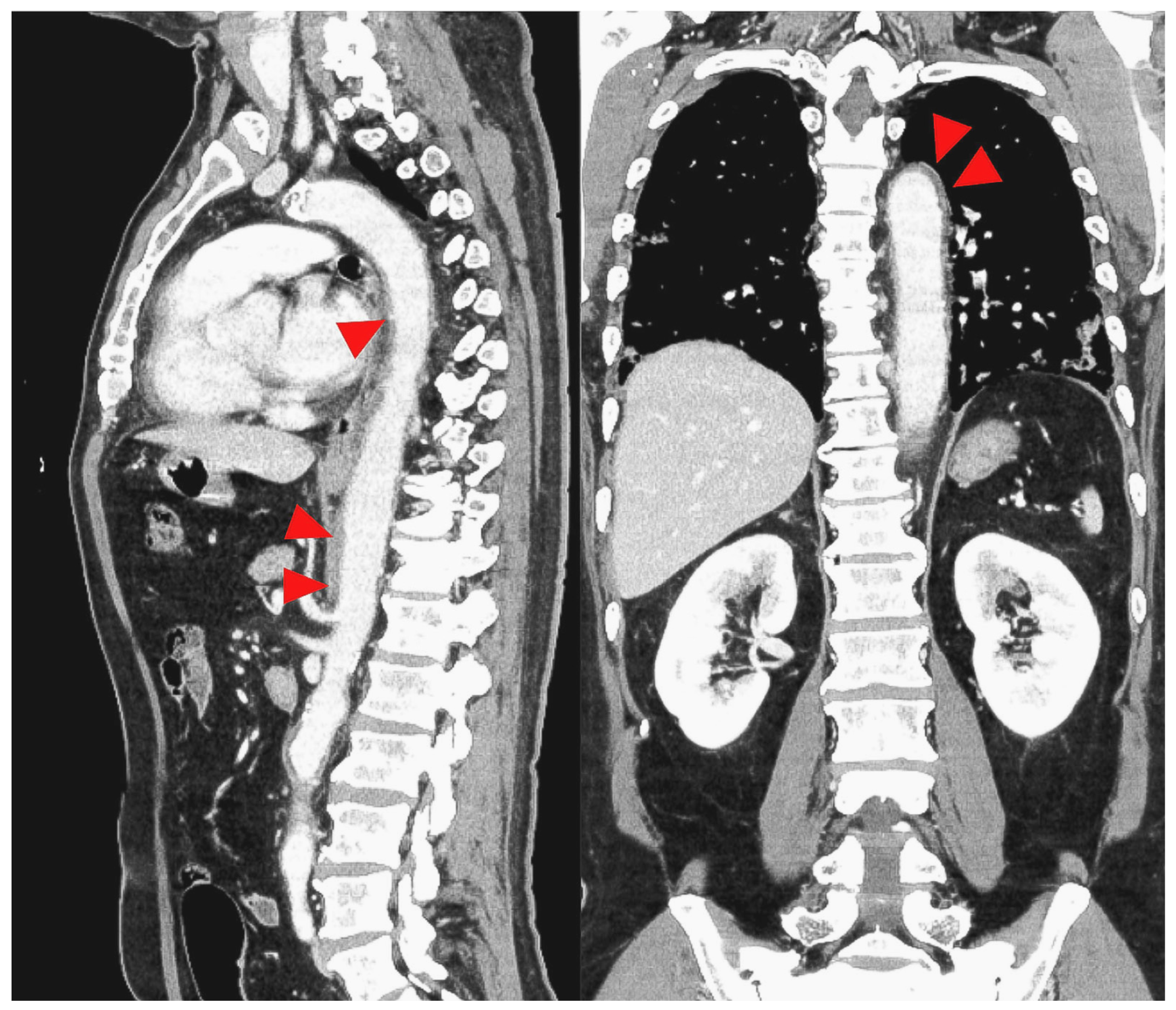 Medicina 59 00816 g004
