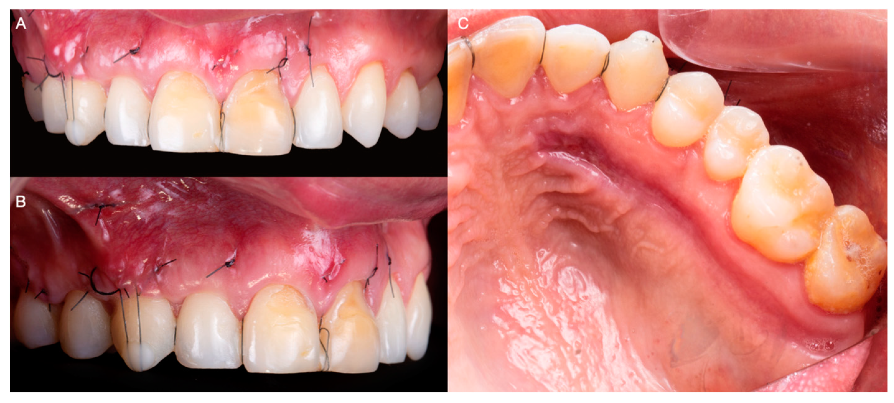 Medicina 59 00822 g006