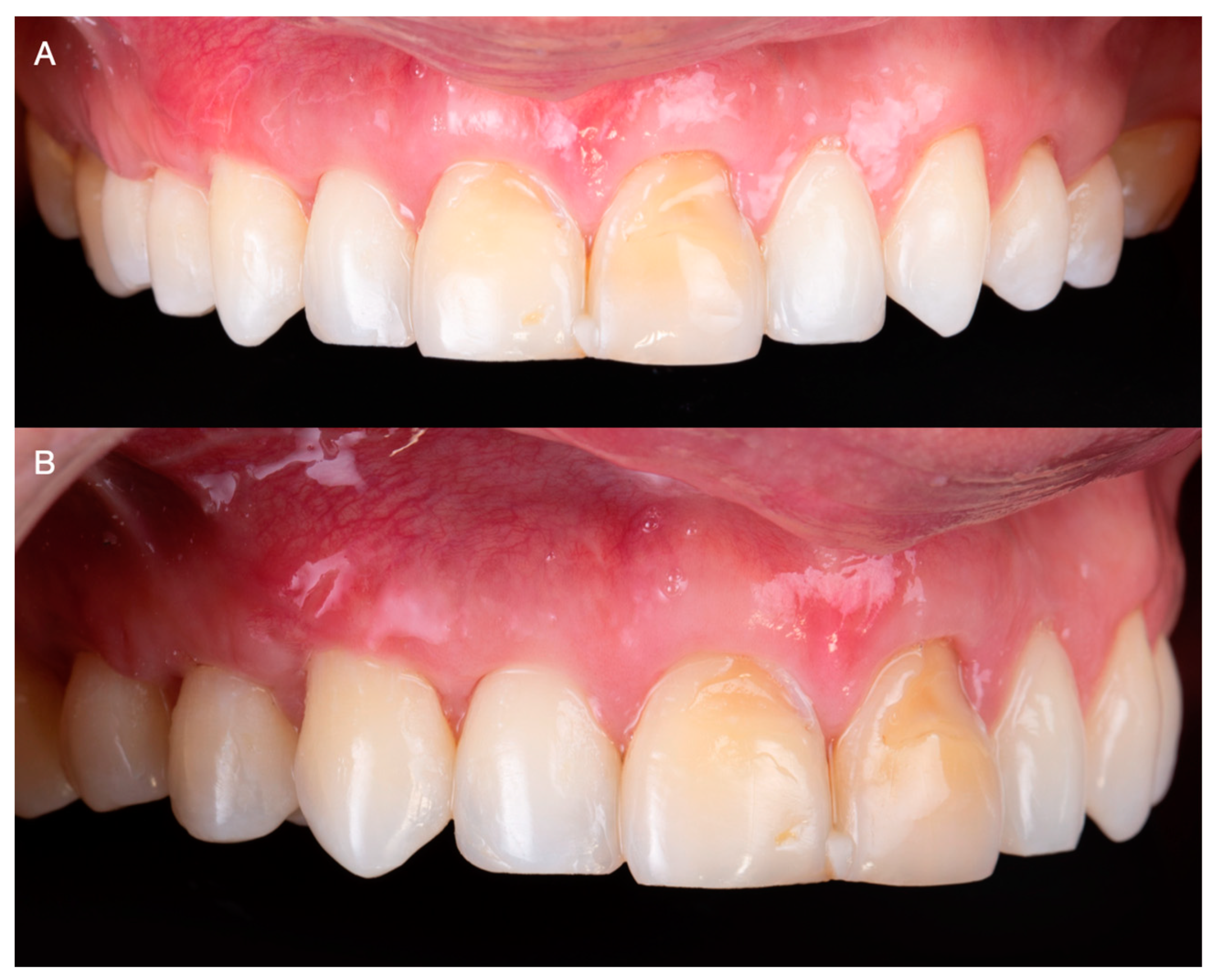 Medicina 59 00822 g007