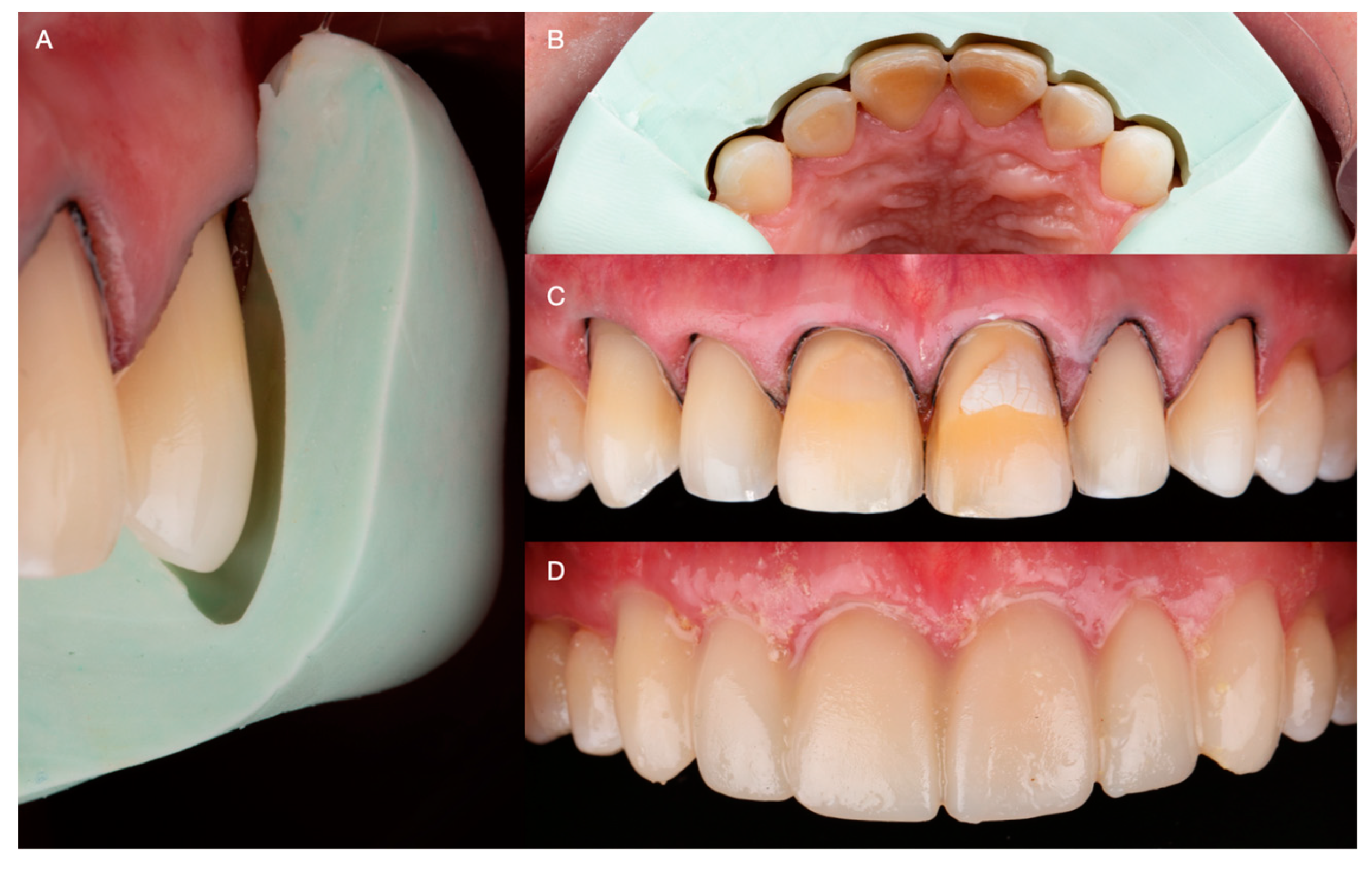 Medicina 59 00822 g008