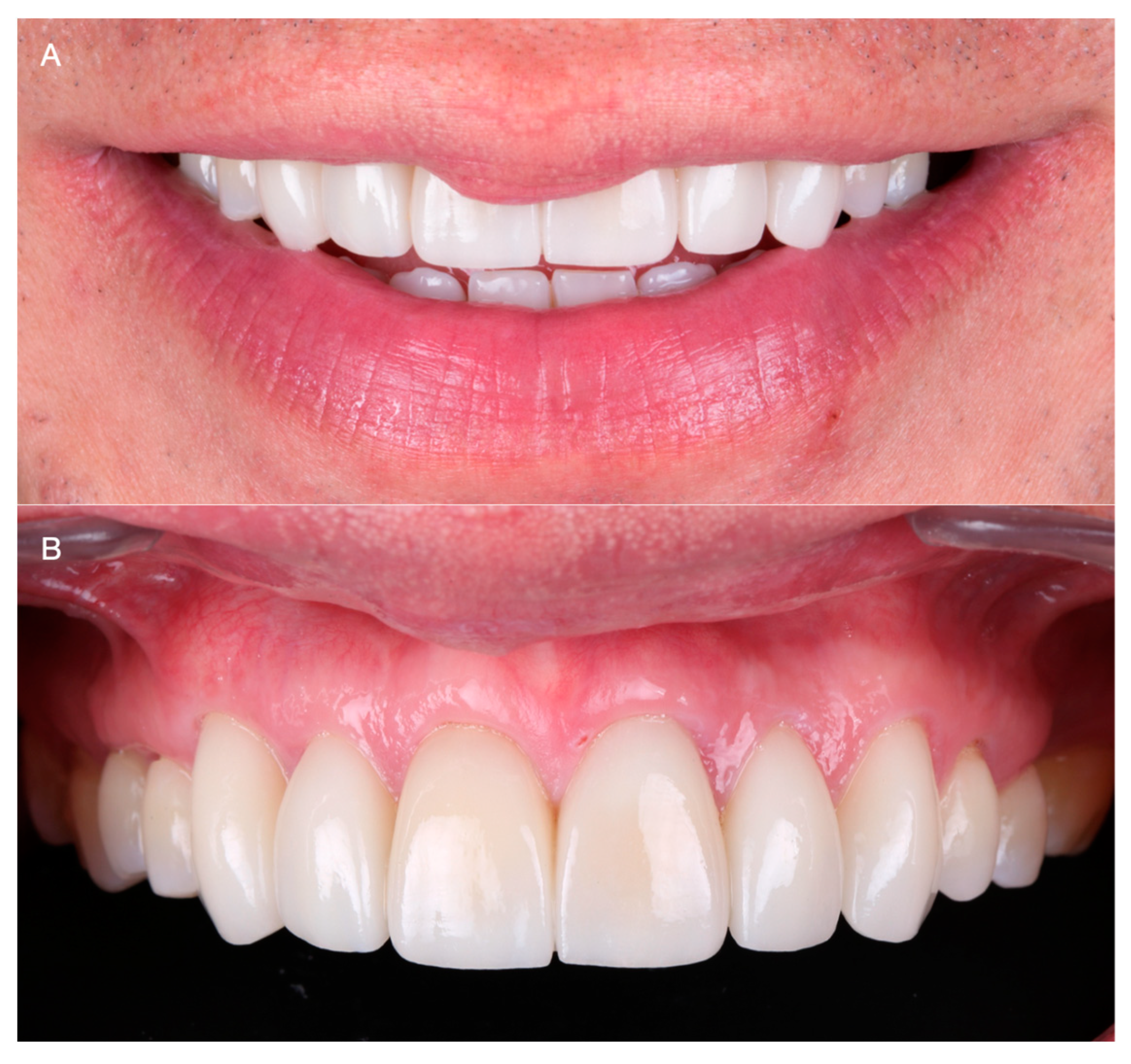 Medicina 59 00822 g010