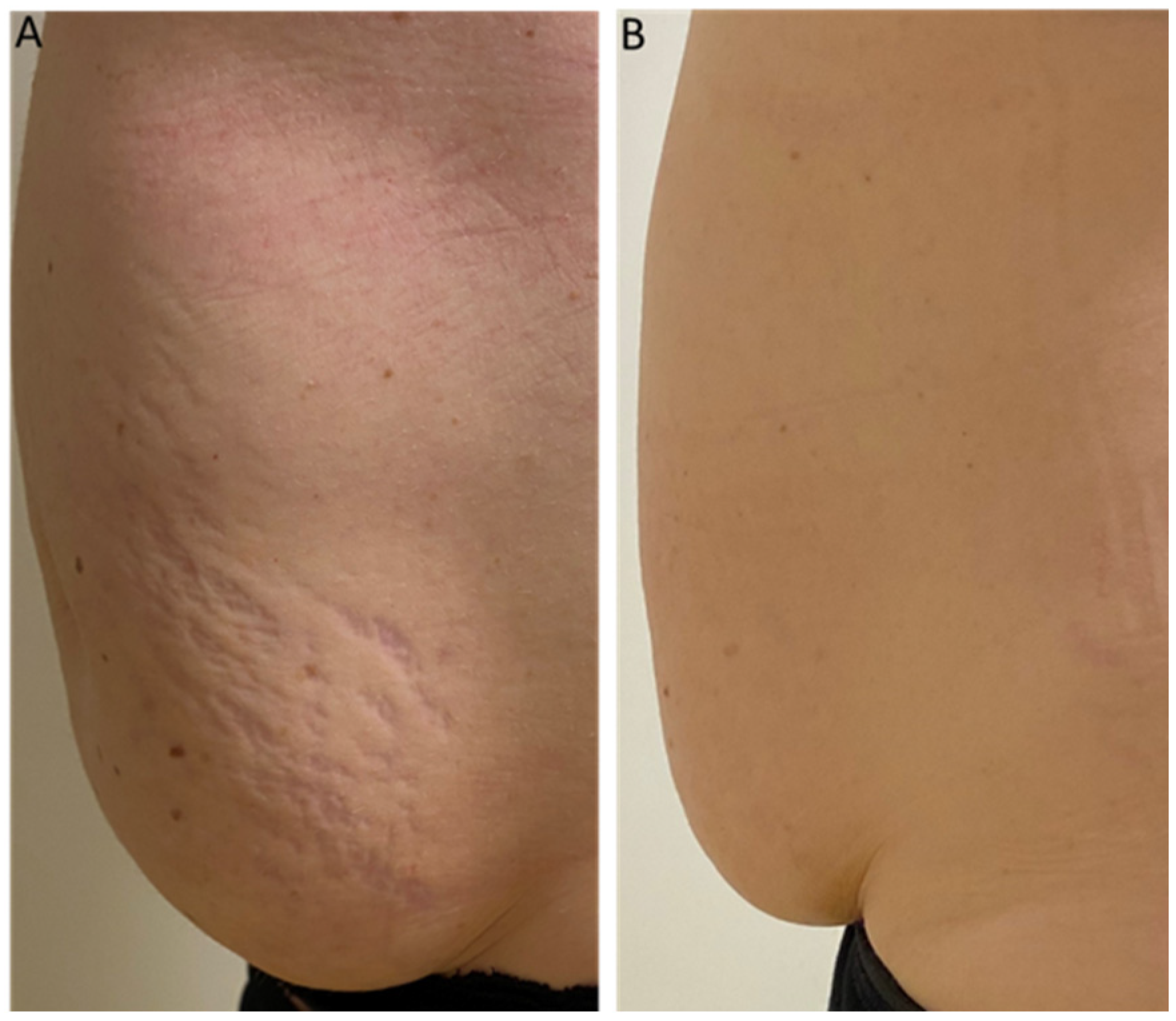 Medicina 59 00841 g003