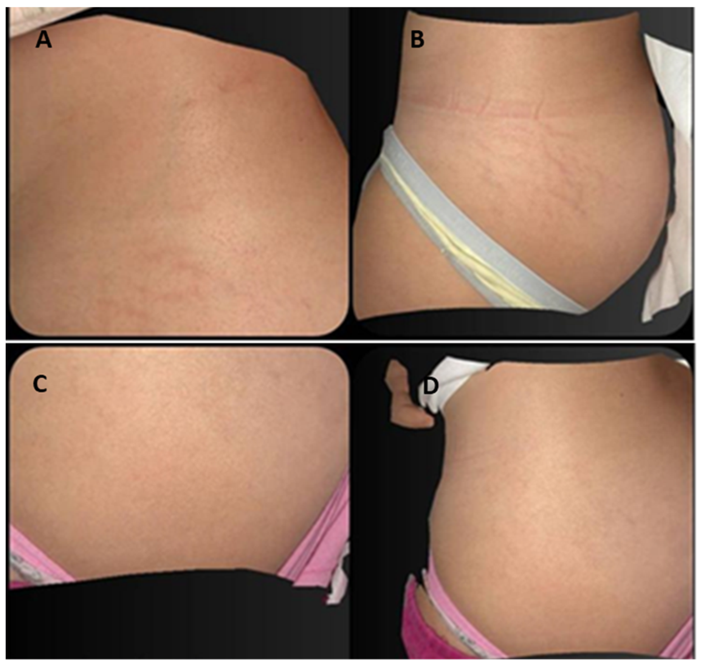 Medicina 59 00841 g004