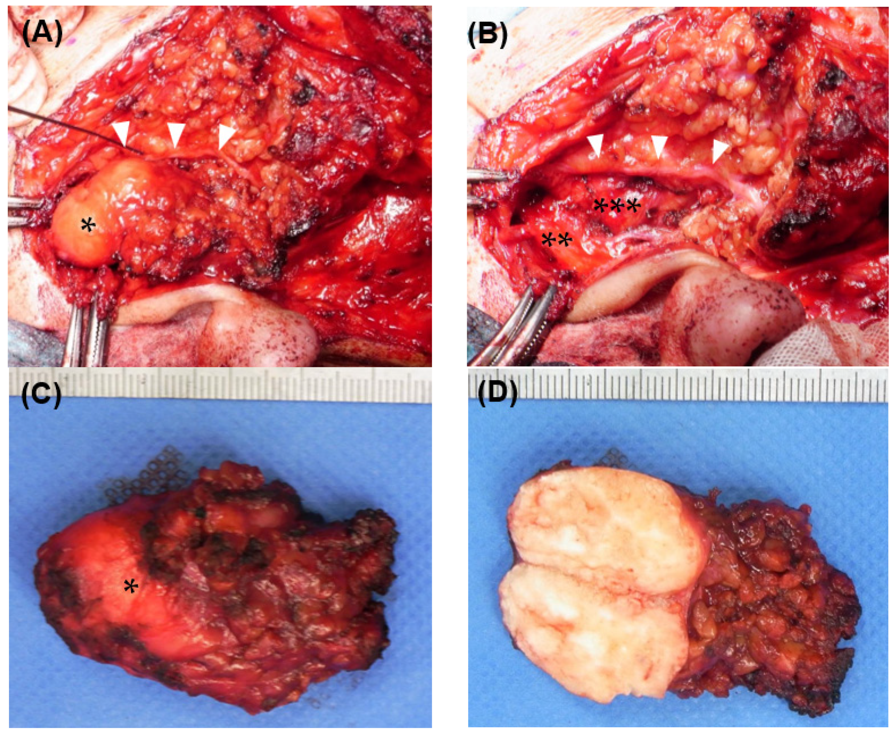Medicina 59 00842 g002