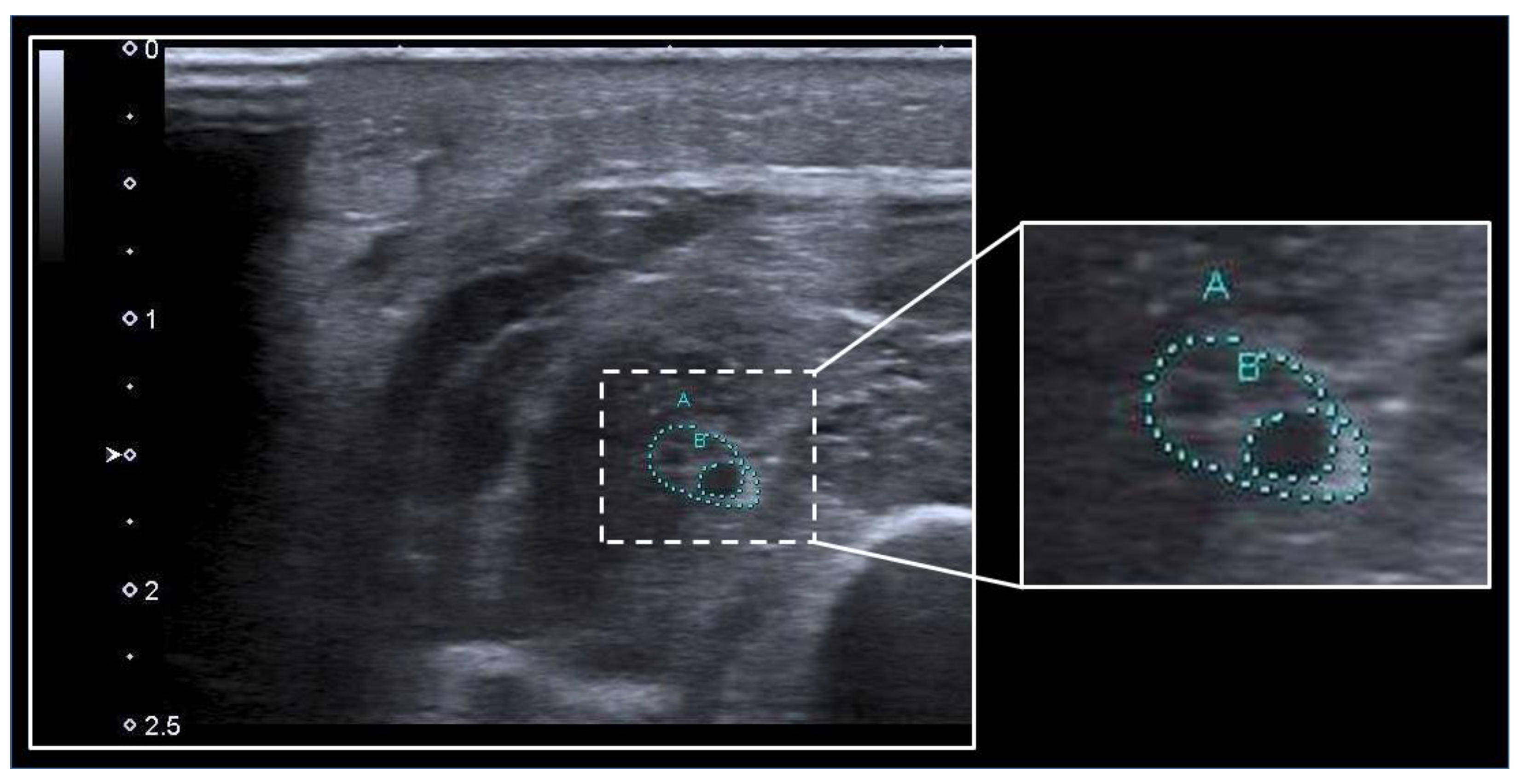 Medicina 59 00844 g002