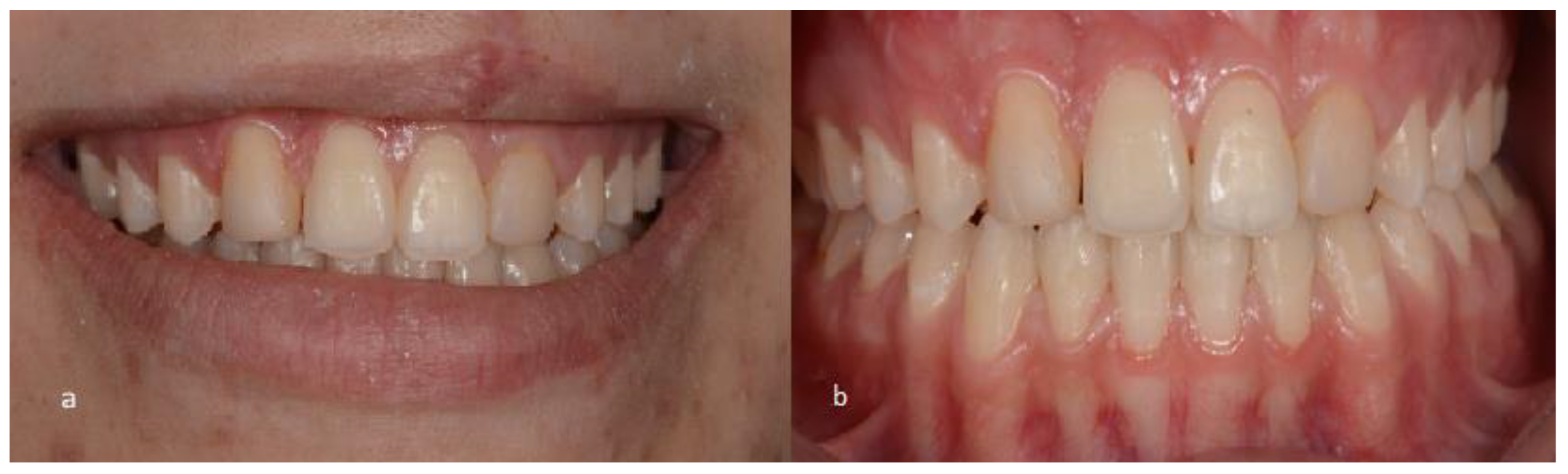 Medicina 59 00849 g001