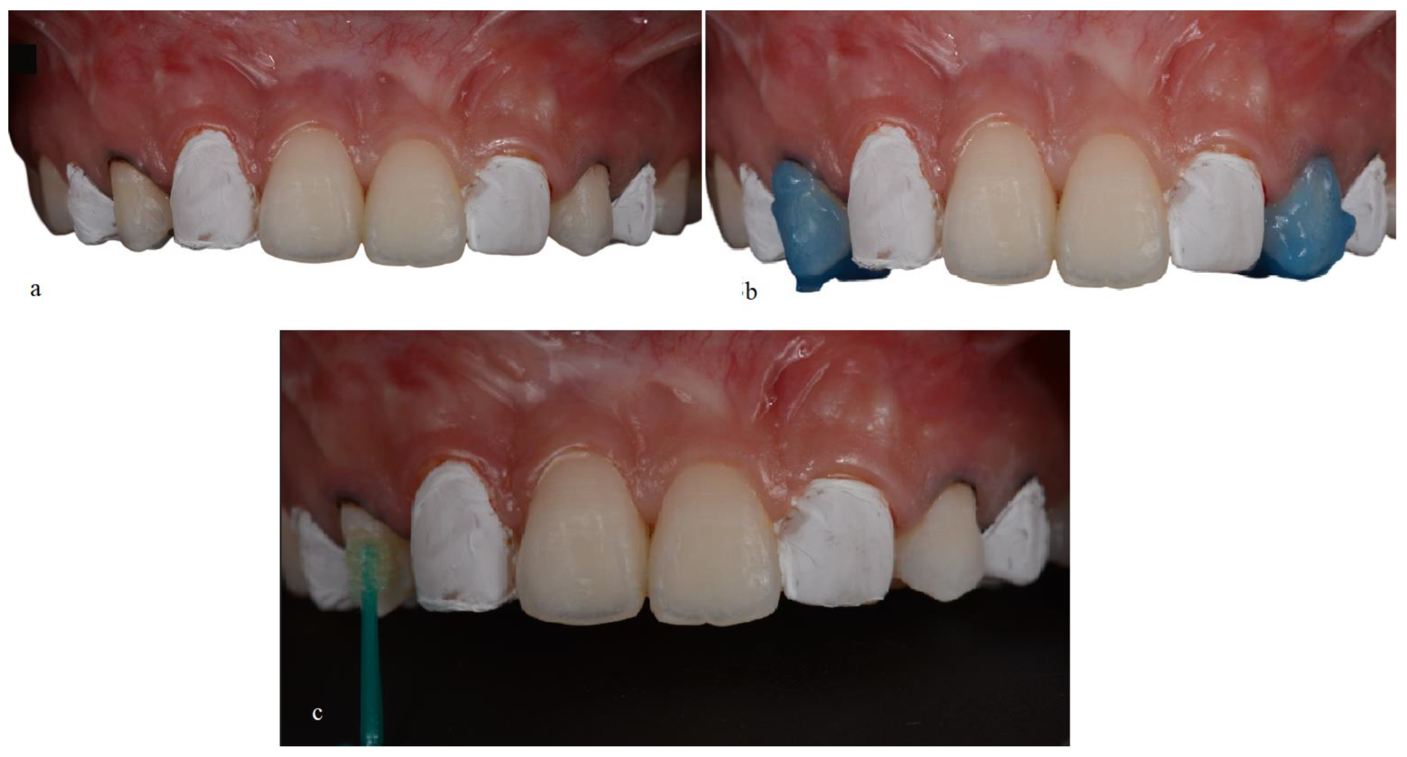 Medicina 59 00849 g005