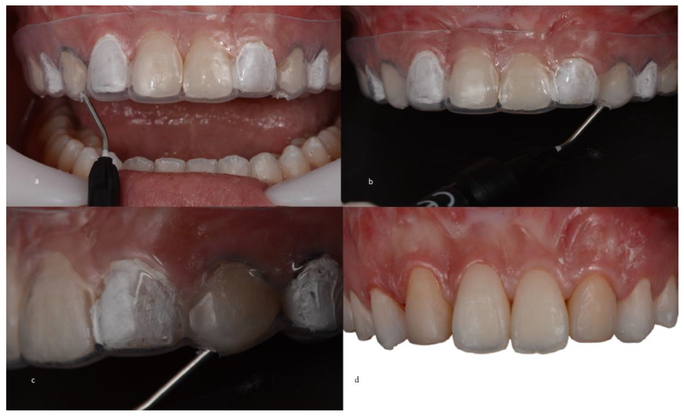 Medicina 59 00849 g006