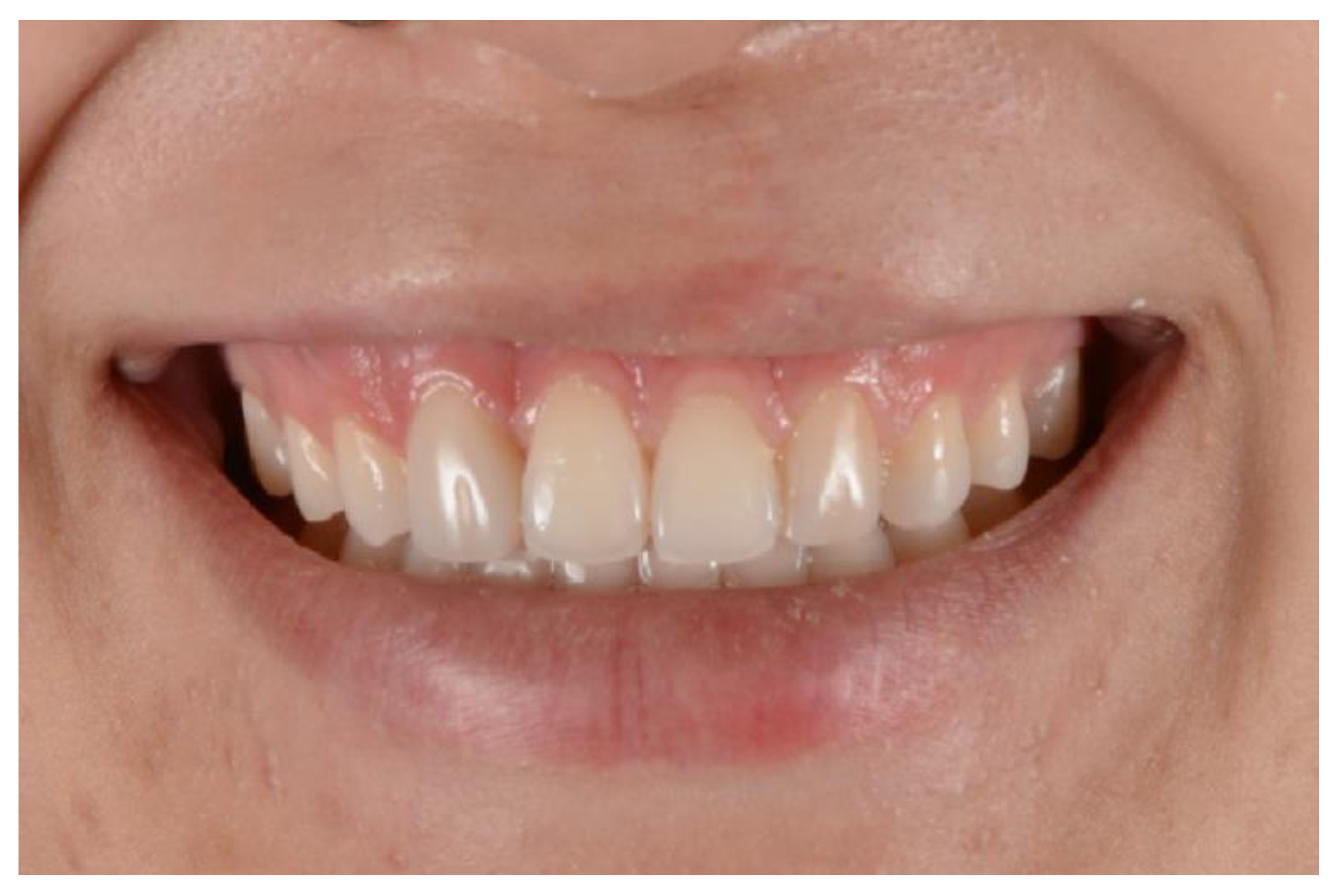 Medicina 59 00849 g008