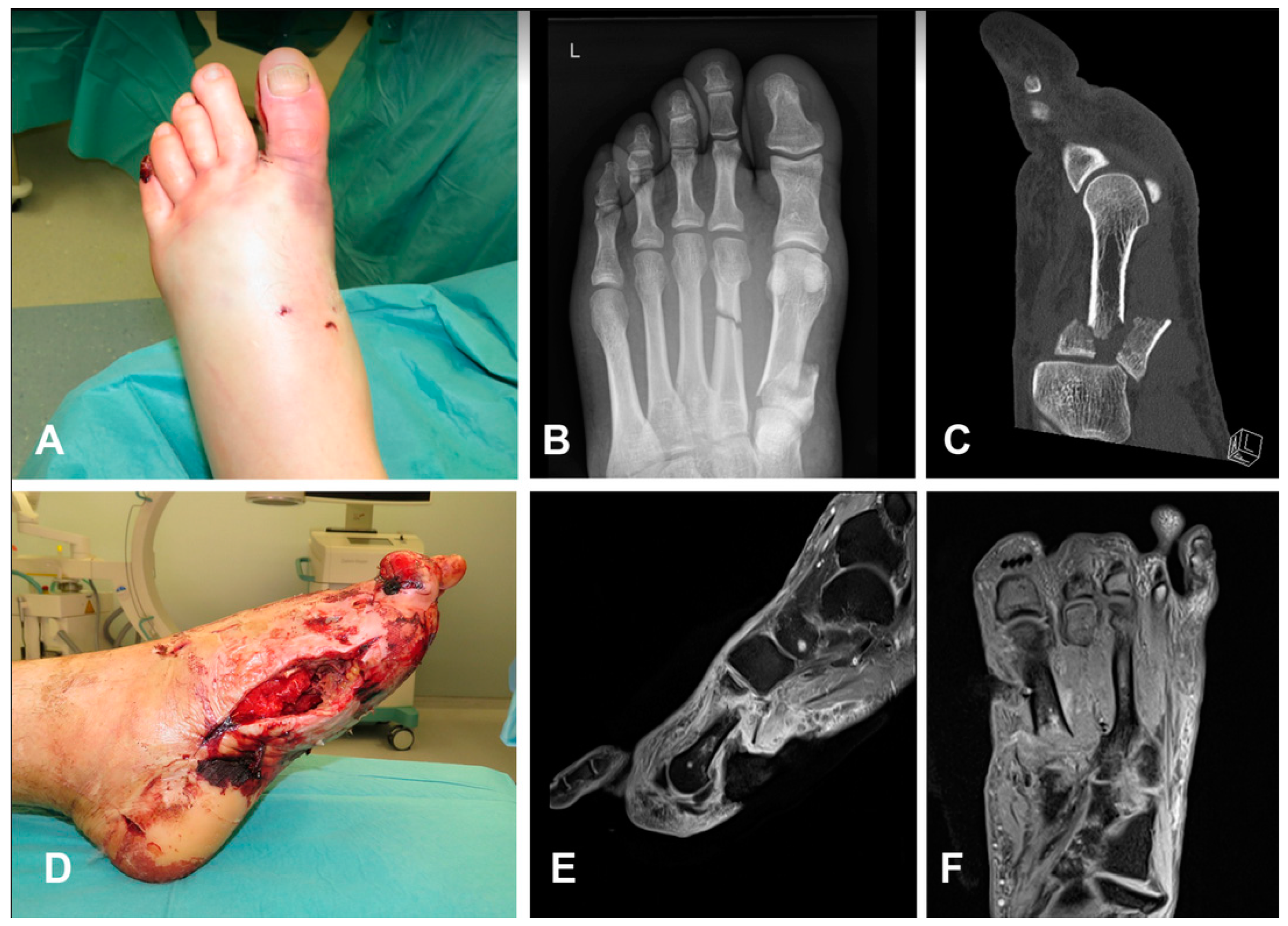 Medicina 59 00859 g002
