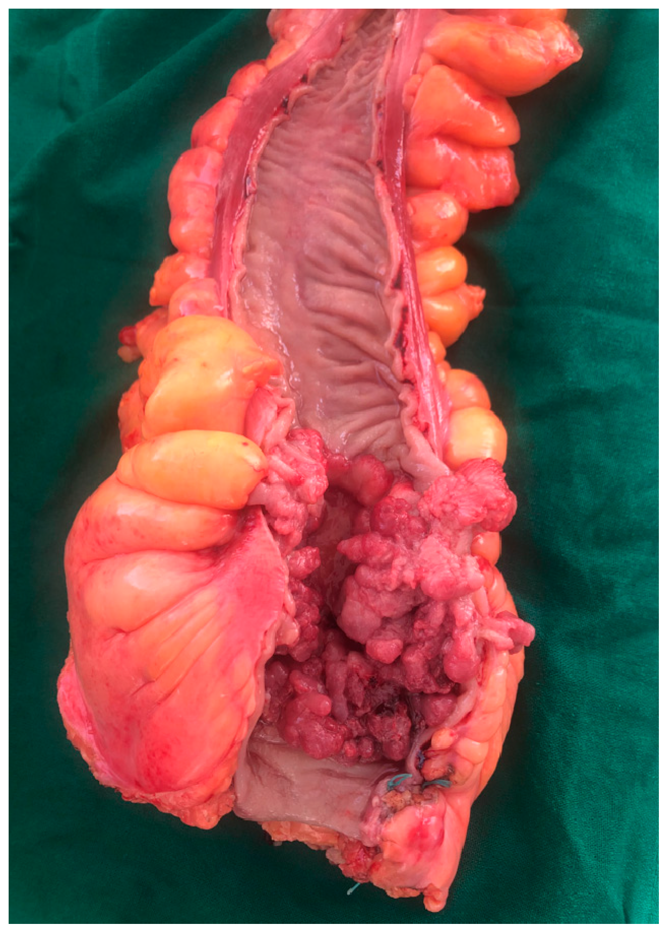 Medicina 59 00875 g002