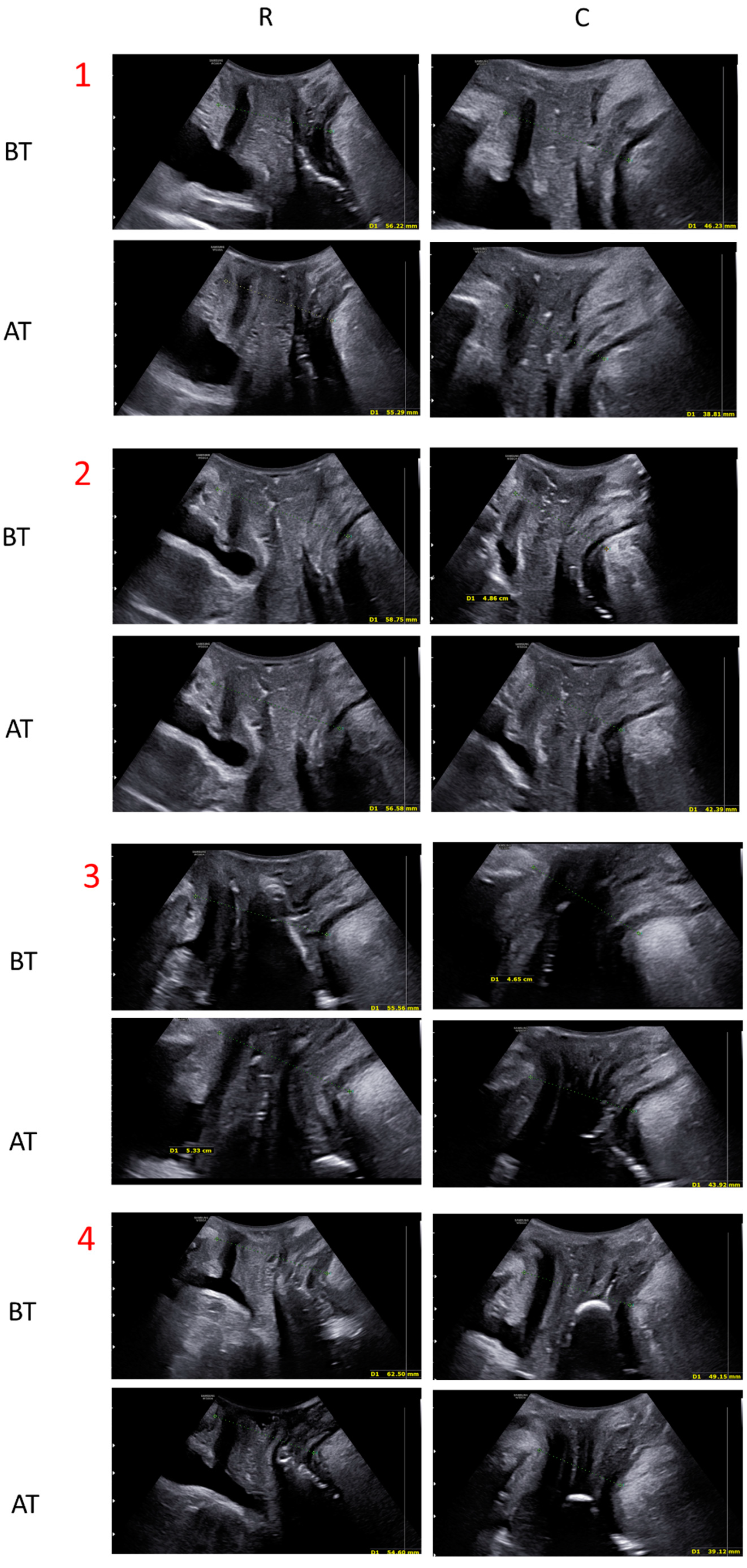 Medicina 59 00879 g005