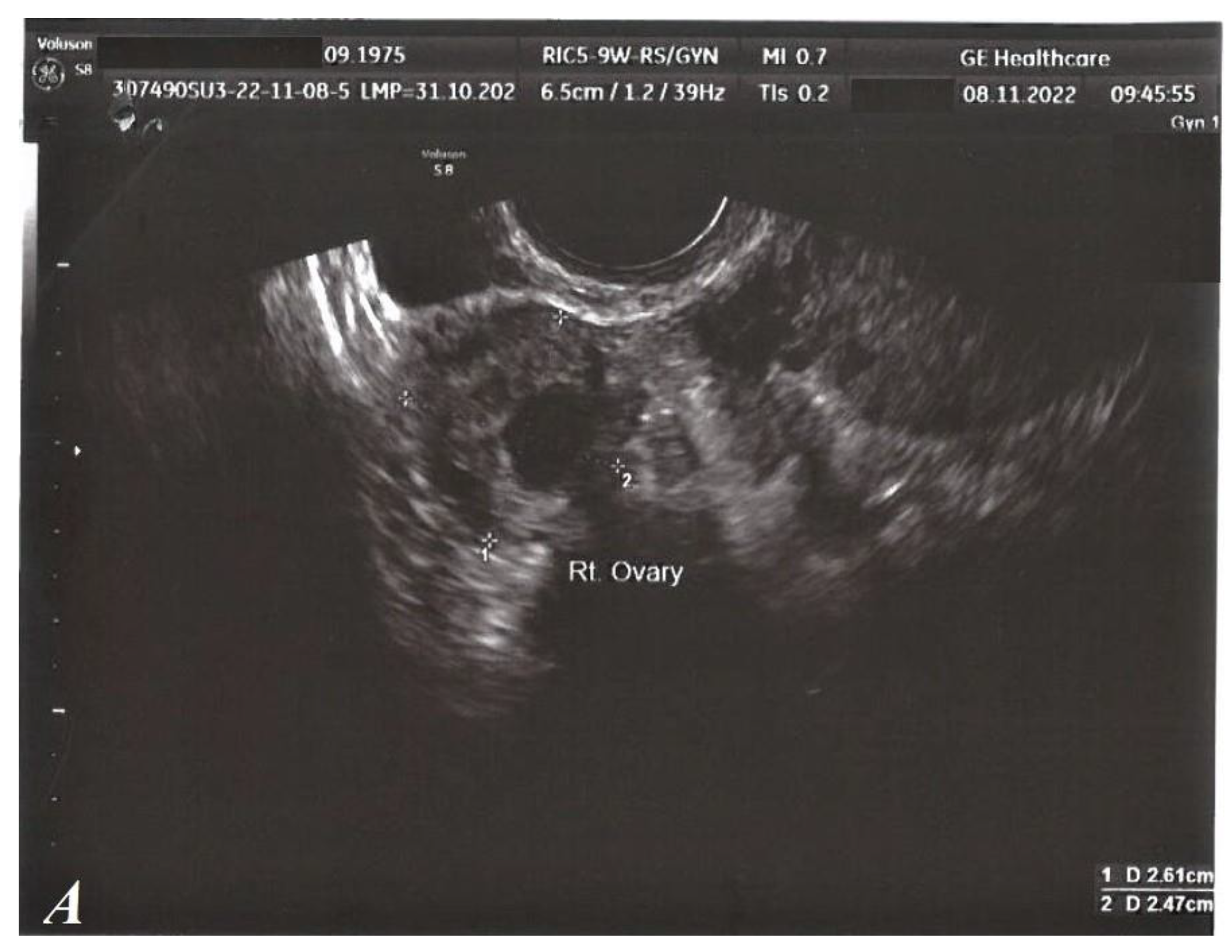 Medicina 59 00884 g002a 550