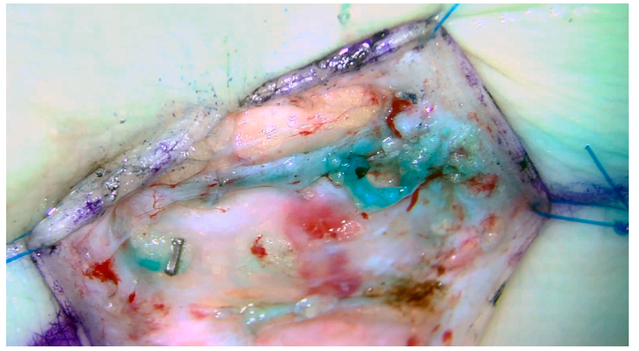 Medicina 59 00894 g004