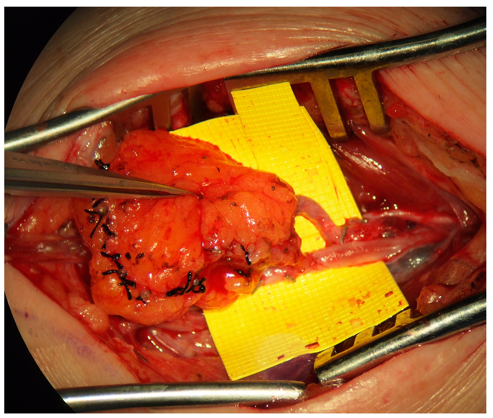 Medicina 59 00894 g005